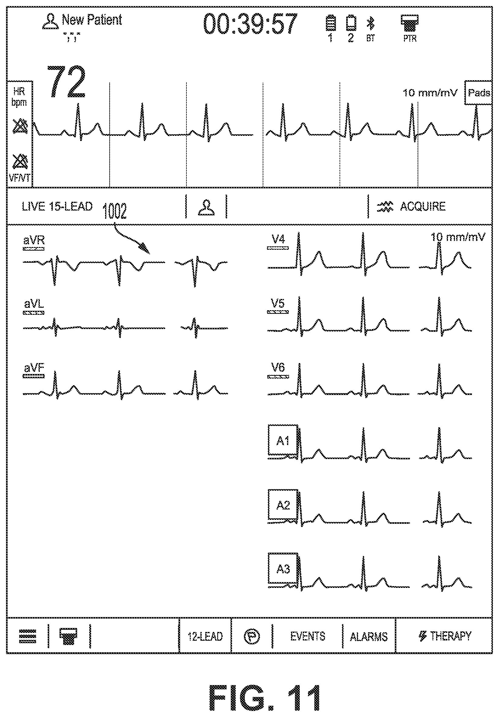 Patent US12616405 Figure 11 – Providing a live-lead view
