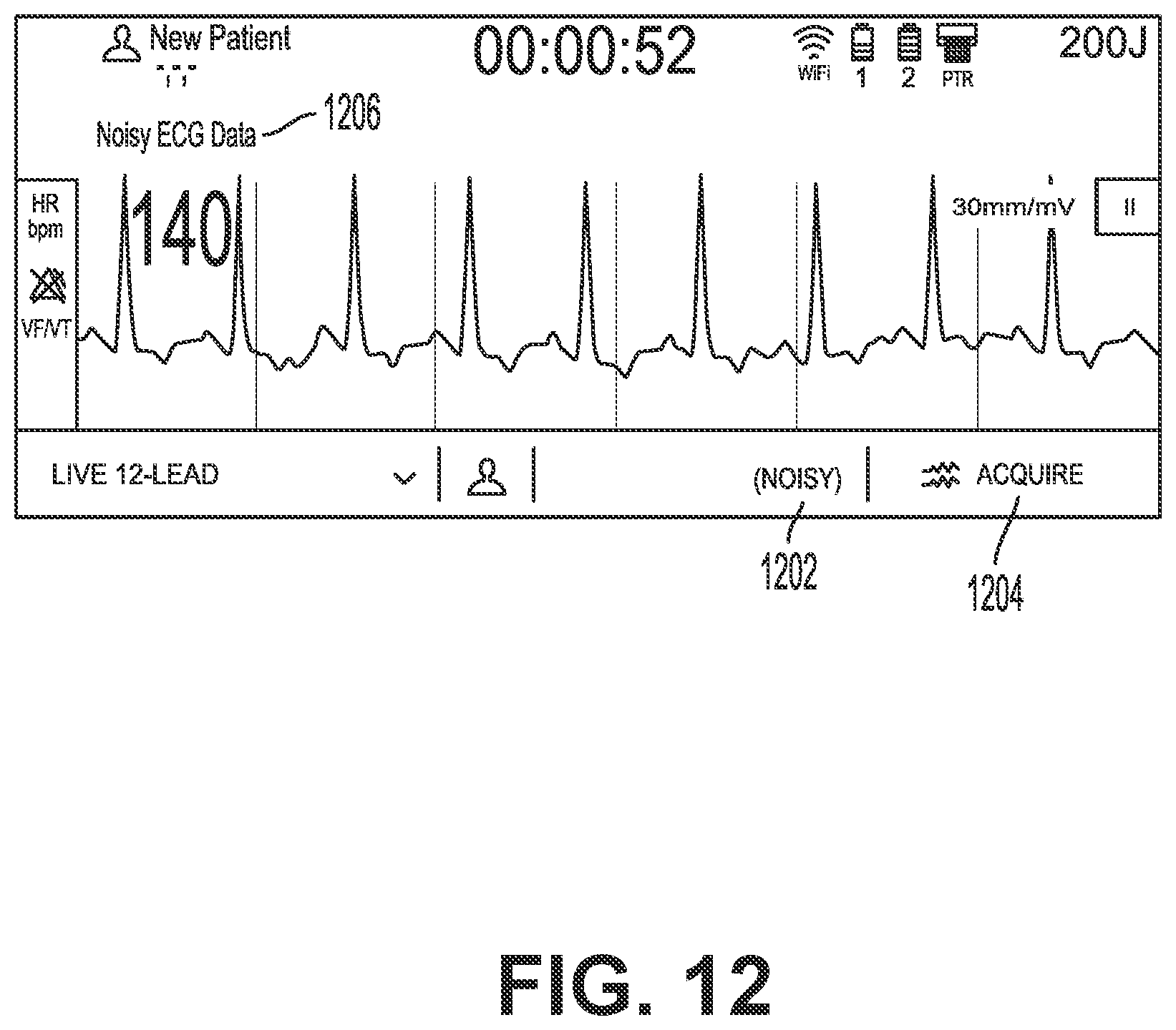 Patent US12616405 Figure 12 – Providing a live-lead view