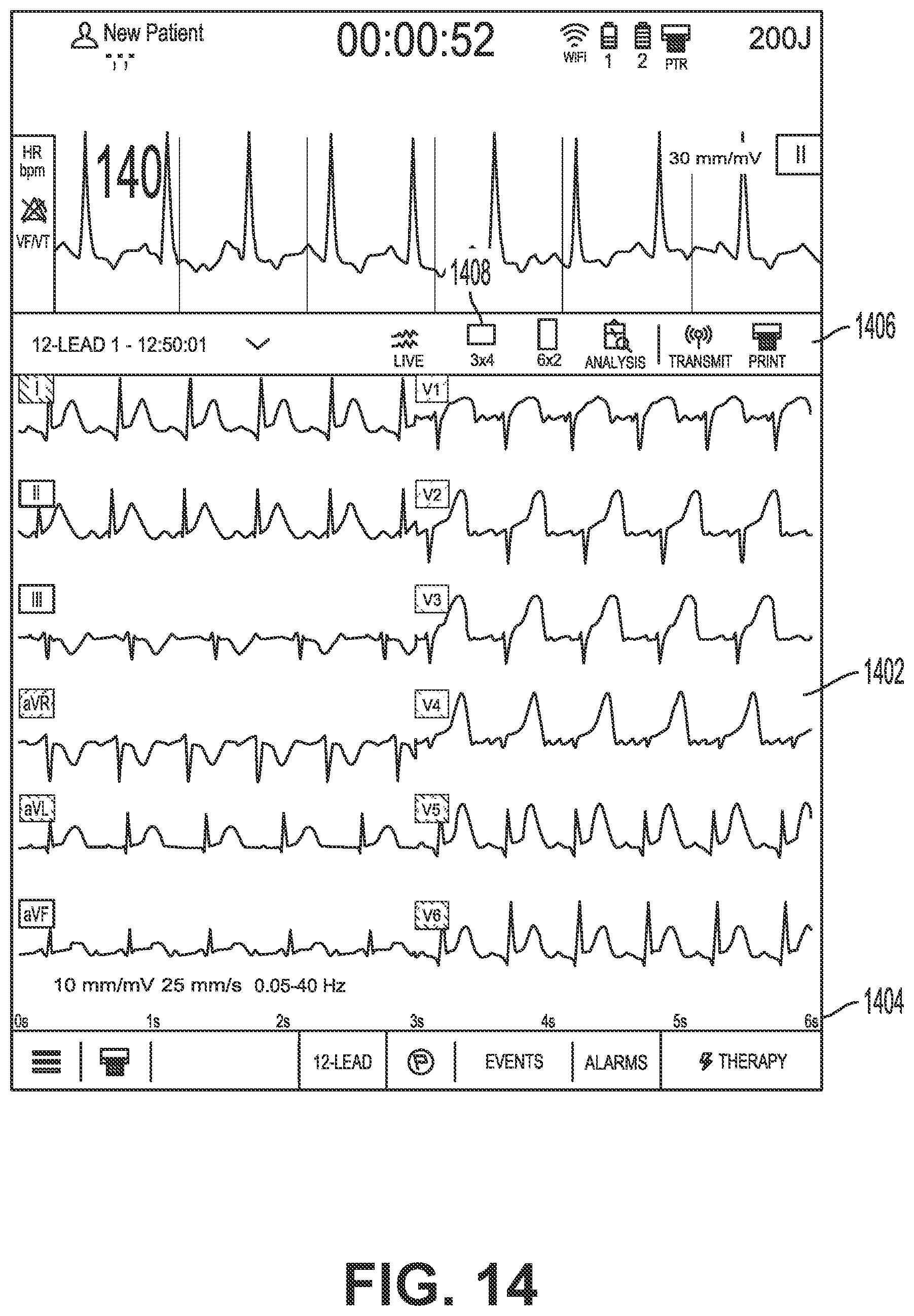 Patent US12616405 Figure 14 – Providing a live-lead view