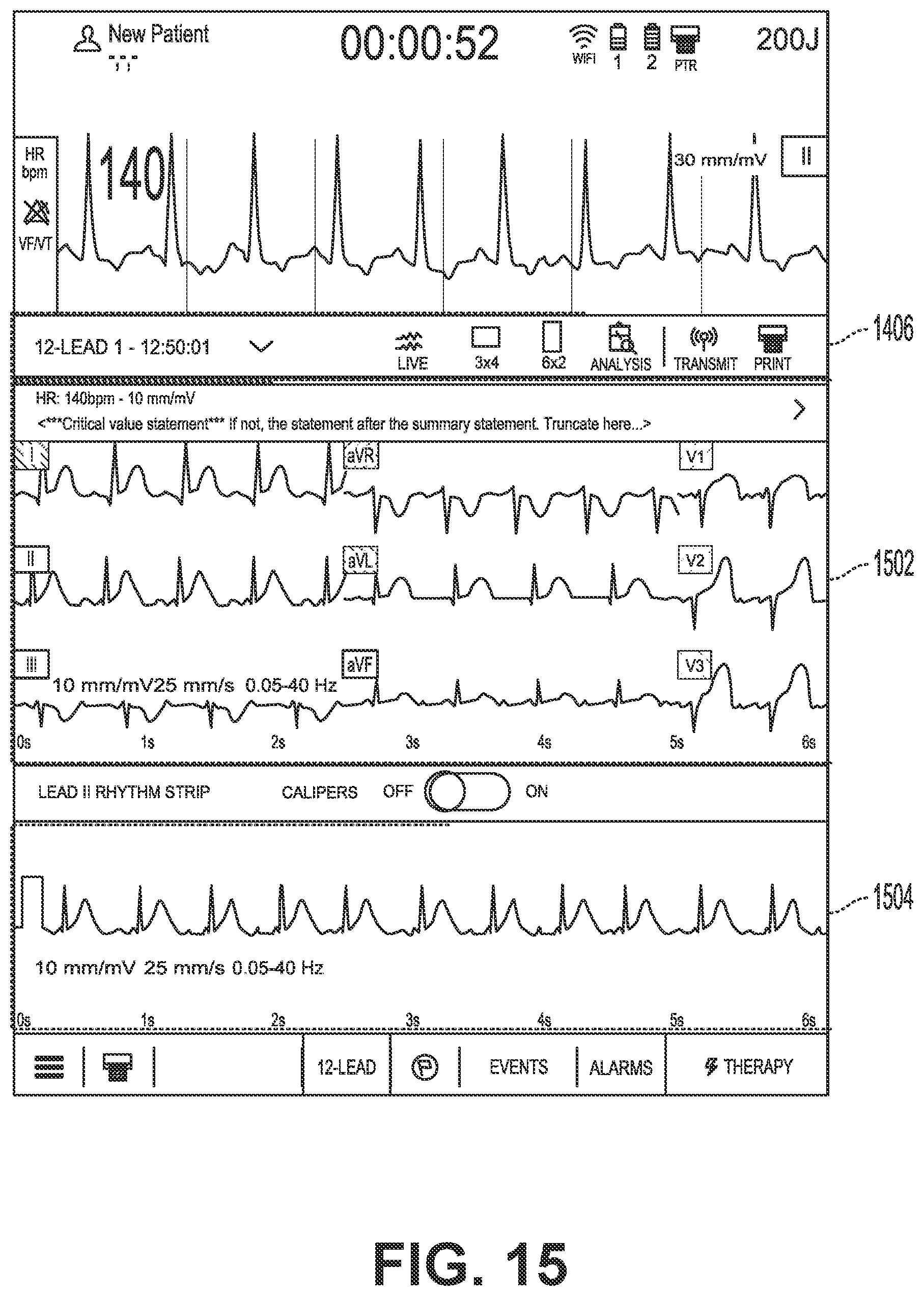 Patent US12616405 Figure 15 – Providing a live-lead view
