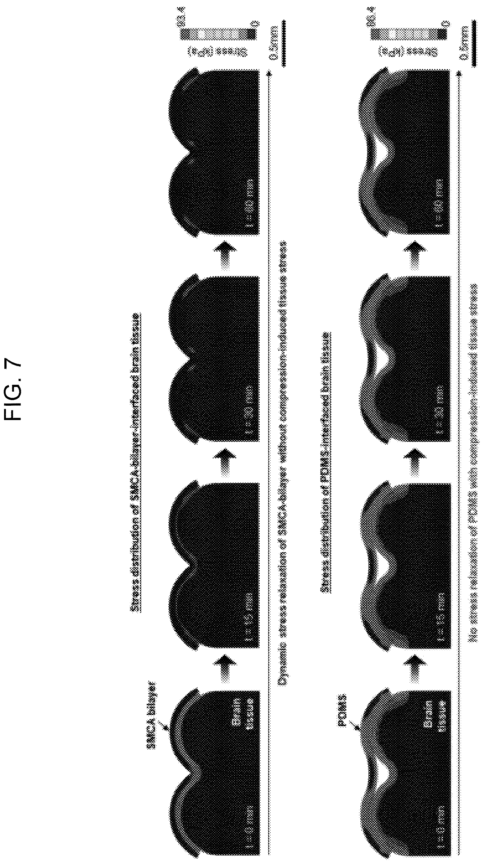 Patent US12616407 Figure 7 – Shape-deformable and elastic bioadhesive electronic device and manufacturing method thereof