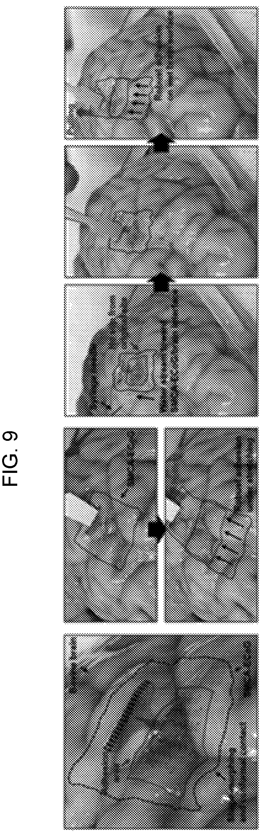 Patent US12616407 Figure 9 – Shape-deformable and elastic bioadhesive electronic device and manufacturing method thereof