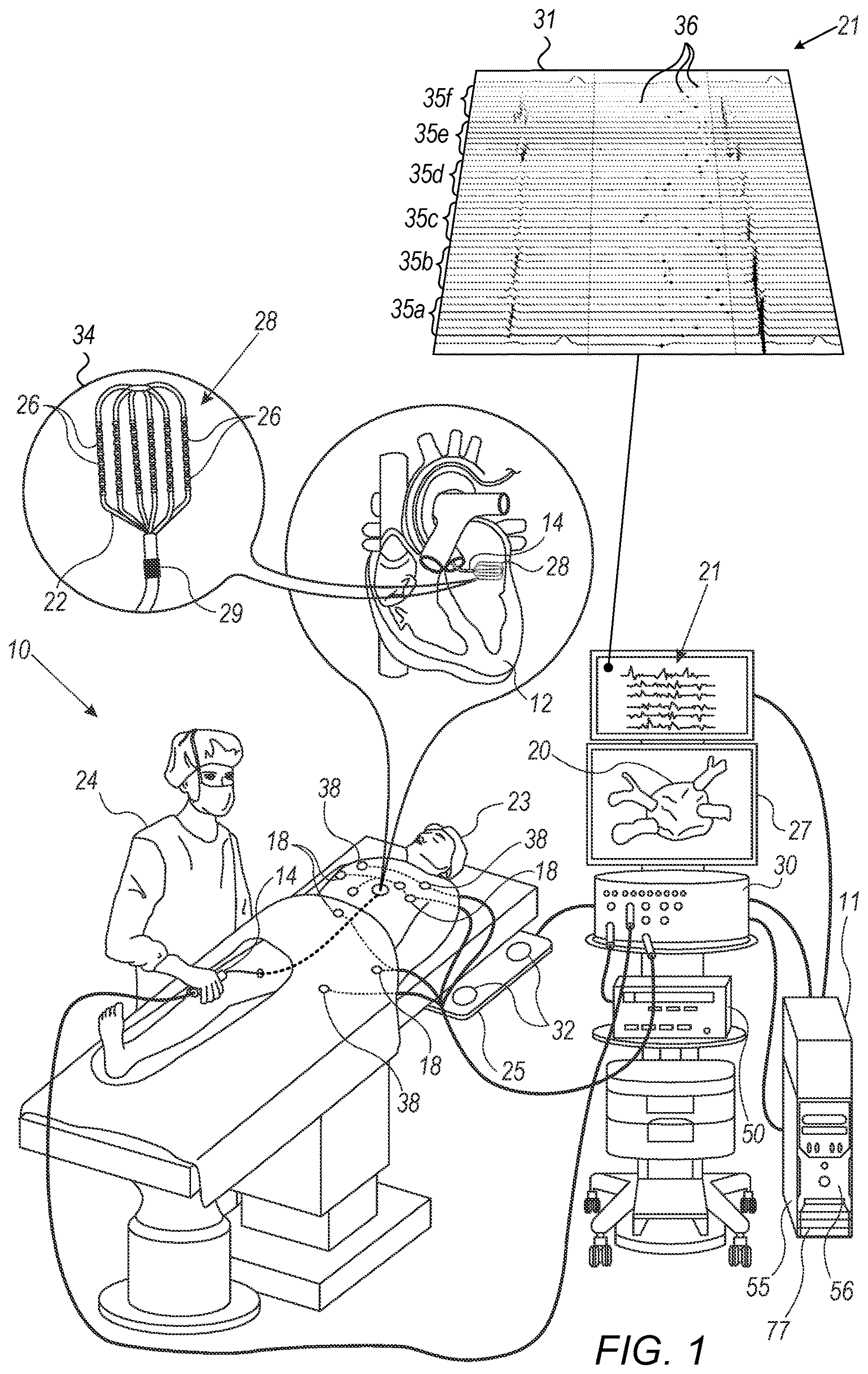 Patent US12616409 Figure 1 – Three-dimensional display of a multi-electrode catheter and signals acquired over time