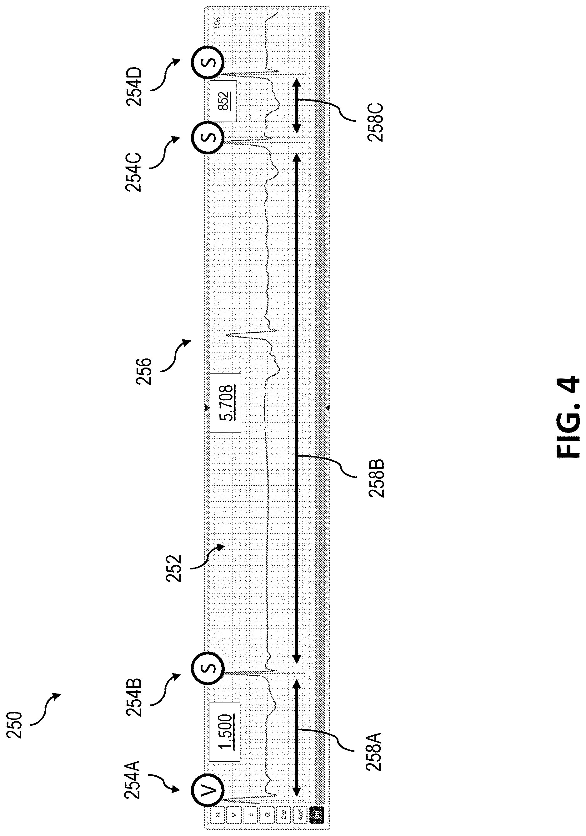 Patent US12616411 Figure 4 – Overriding longest RR intervals