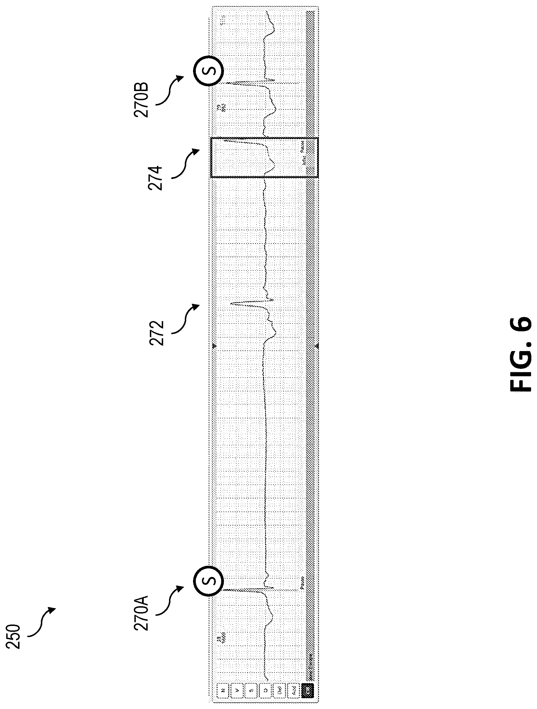 Patent US12616411 Figure 6 – Overriding longest RR intervals