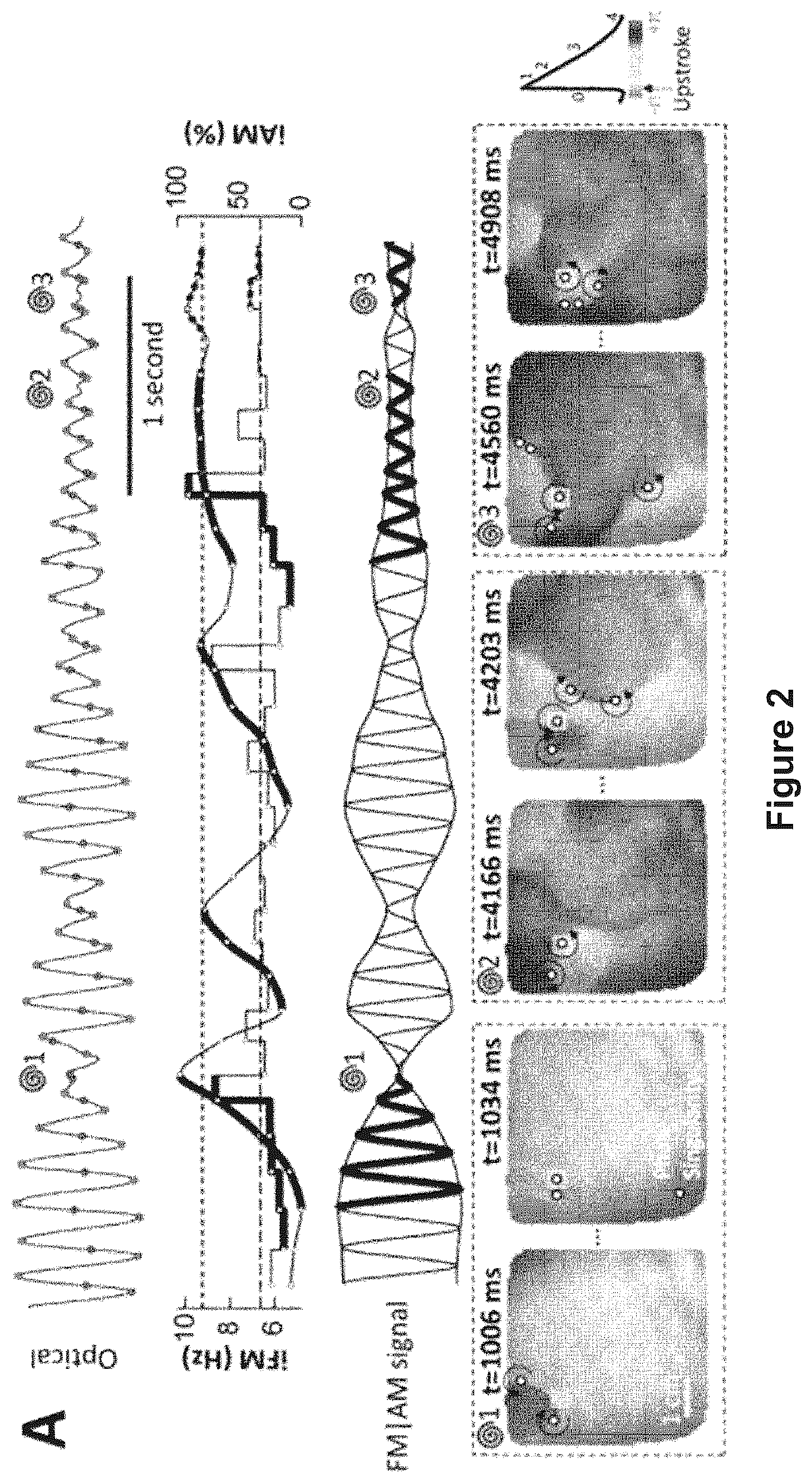 Patent US12616412 Figure 3 – Method for the identification of cardiac fibrillation drivers and/or the footprint of rotational activations using single optical or electrical signals without requiring panoramic simultaneous acquisition