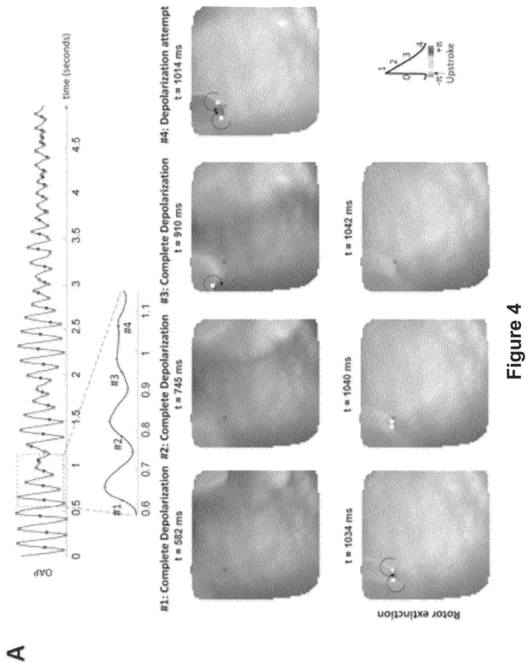 Patent US12616412 Figure 9 – Method for the identification of cardiac fibrillation drivers and/or the footprint of rotational activations using single optical or electrical signals without requiring panoramic simultaneous acquisition