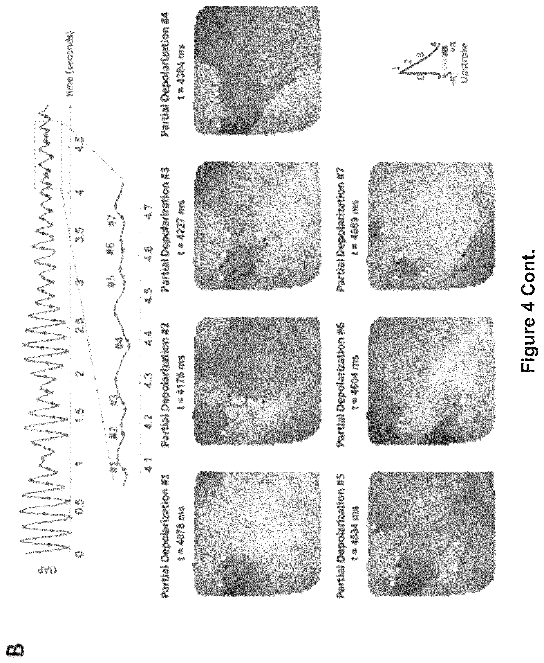 Patent US12616412 Figure 10 – Method for the identification of cardiac fibrillation drivers and/or the footprint of rotational activations using single optical or electrical signals without requiring panoramic simultaneous acquisition