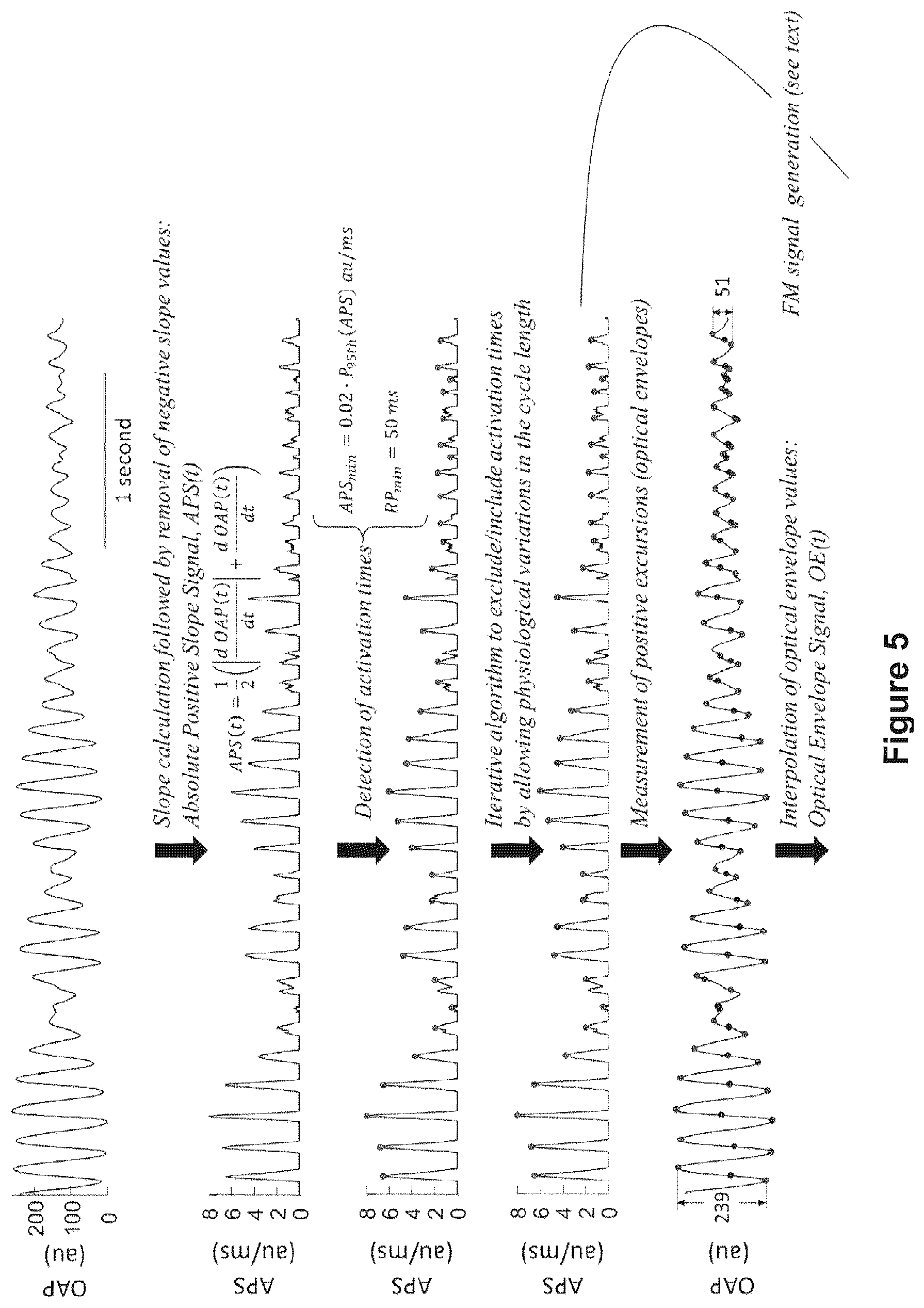 Patent US12616412 Figure 11 – Method for the identification of cardiac fibrillation drivers and/or the footprint of rotational activations using single optical or electrical signals without requiring panoramic simultaneous acquisition