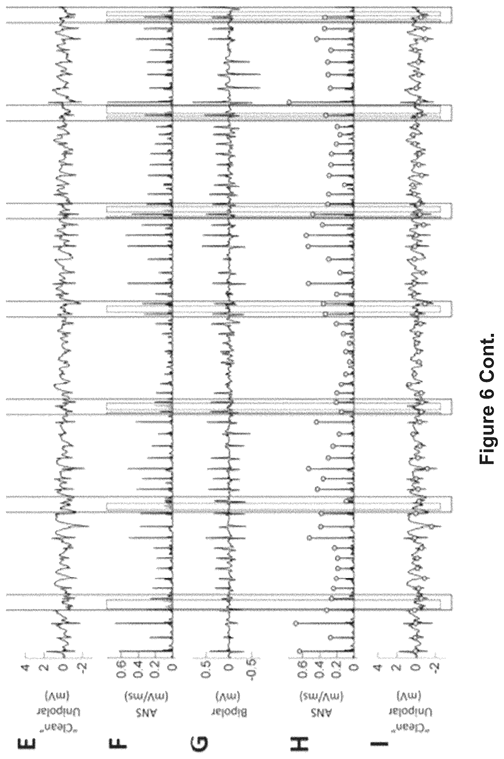Patent US12616412 Figure 15 – Method for the identification of cardiac fibrillation drivers and/or the footprint of rotational activations using single optical or electrical signals without requiring panoramic simultaneous acquisition