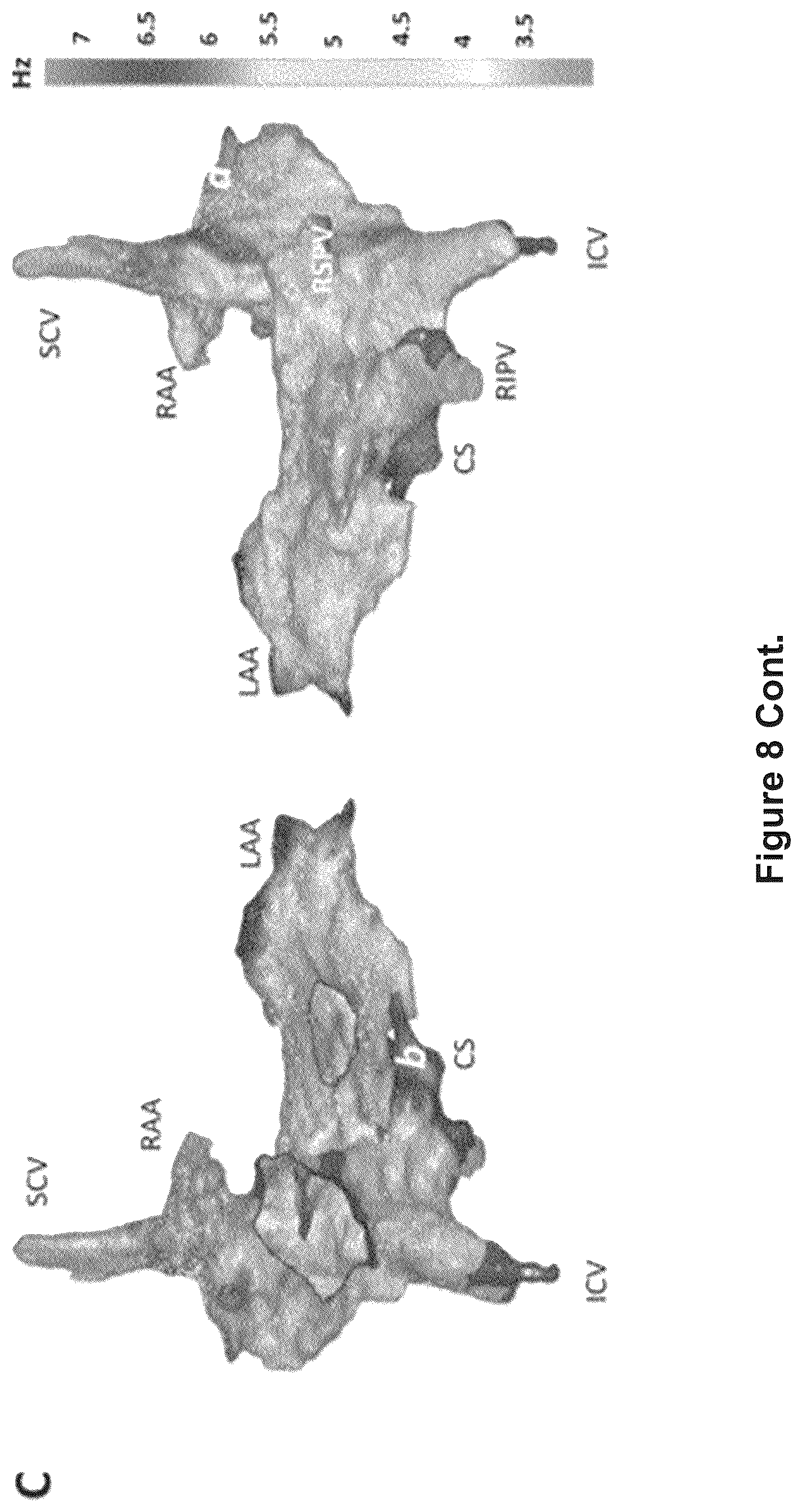 Patent US12616412 Figure 20 – Method for the identification of cardiac fibrillation drivers and/or the footprint of rotational activations using single optical or electrical signals without requiring panoramic simultaneous acquisition