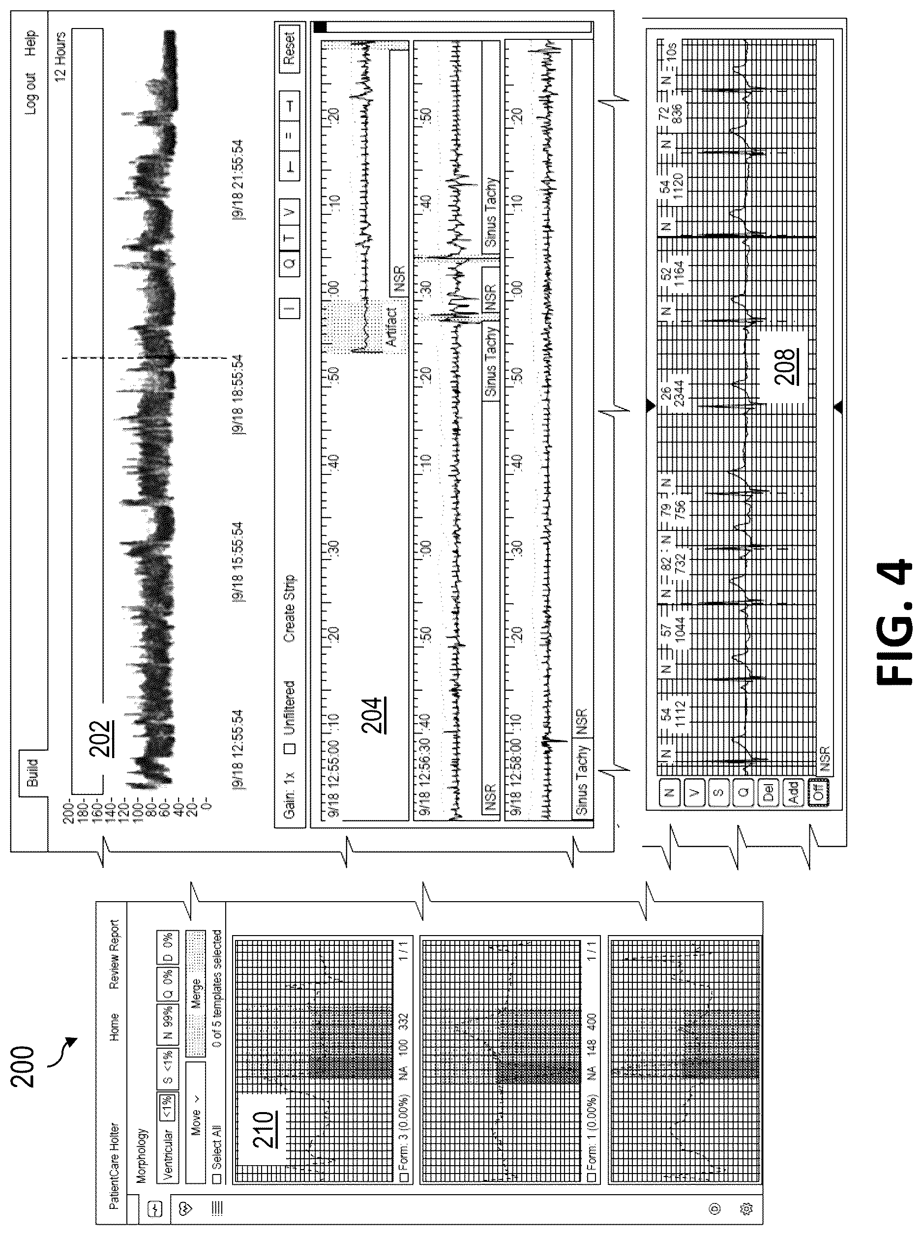 Patent US12616413 Figure 4 – Beat and rhythm reclassification