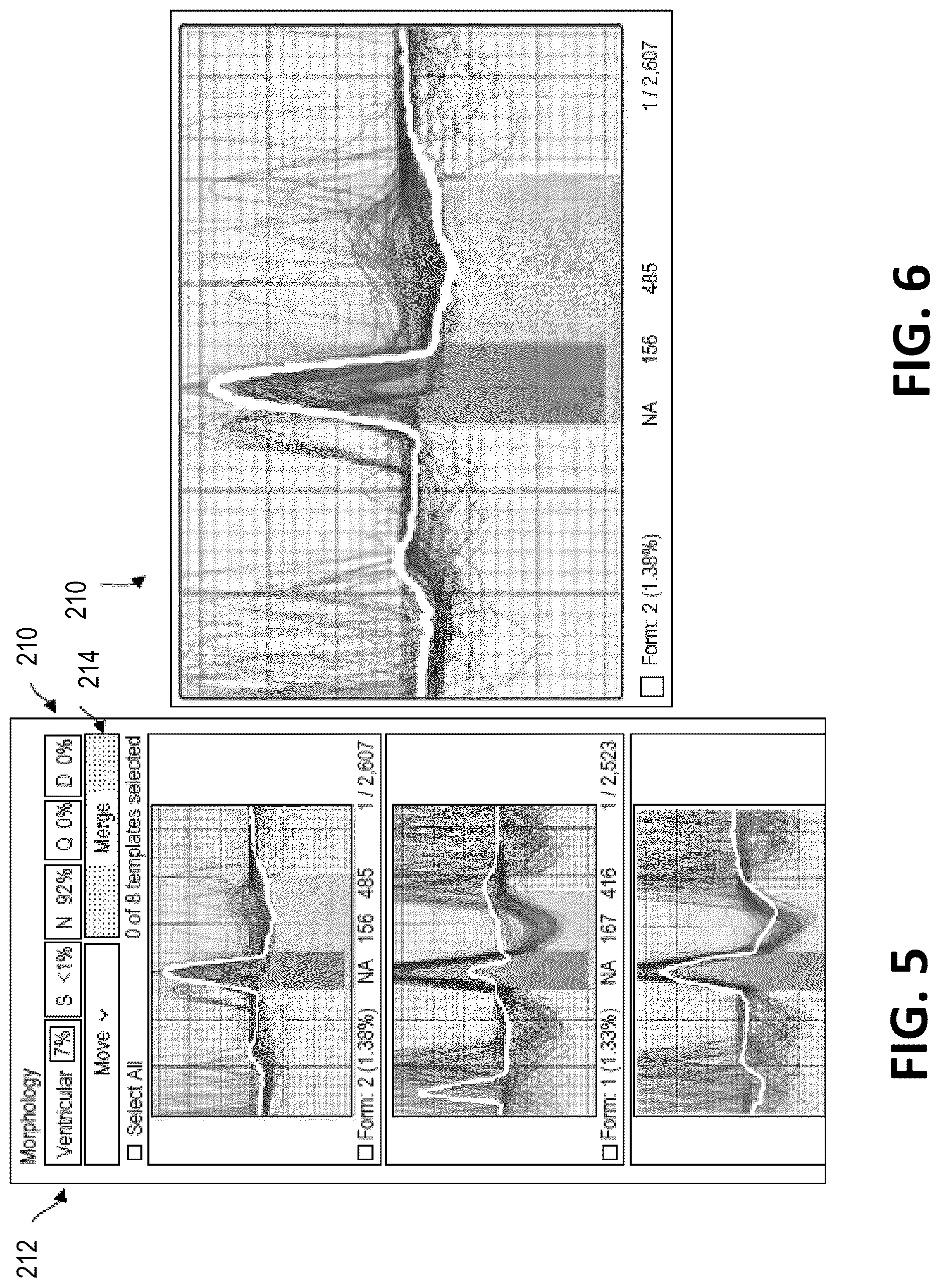 Patent US12616413 Figure 5 – Beat and rhythm reclassification