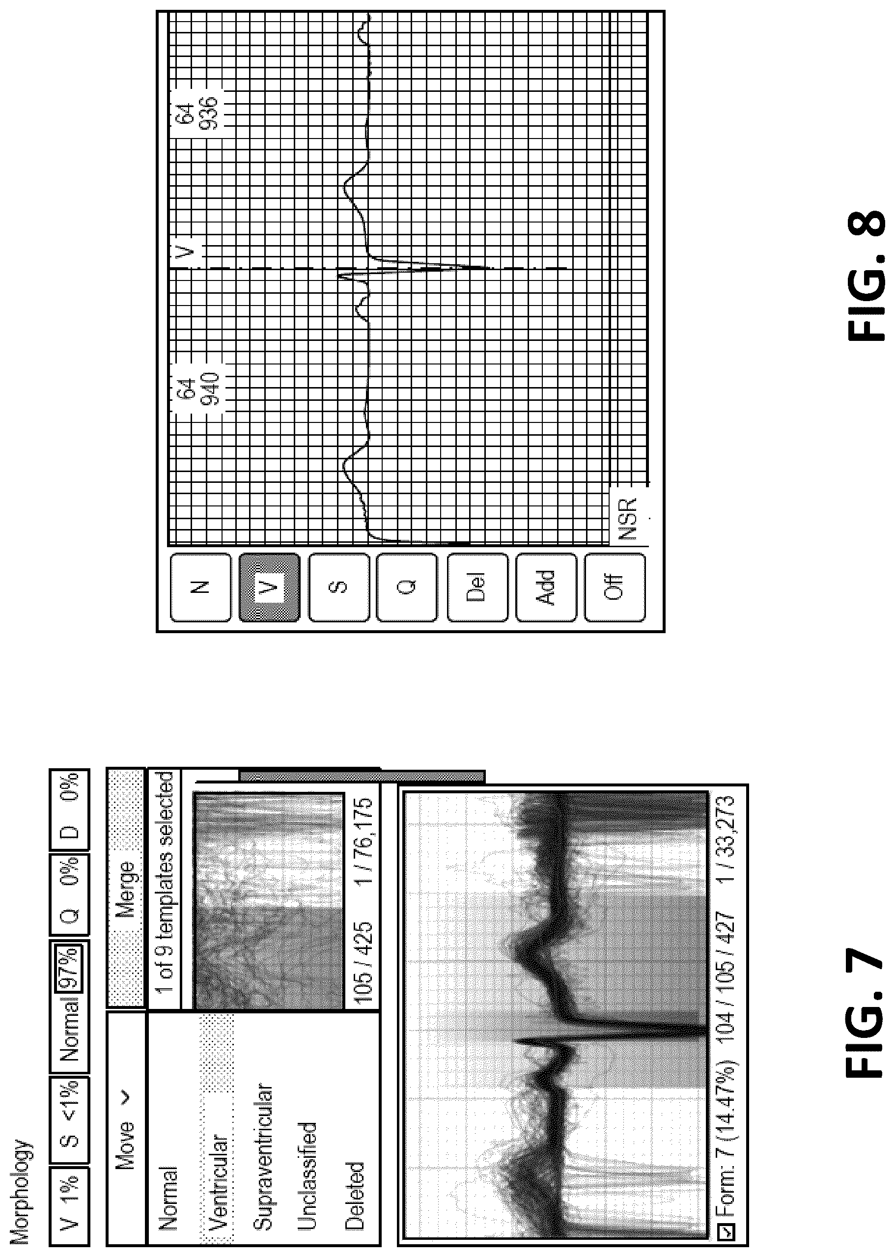 Patent US12616413 Figure 6 – Beat and rhythm reclassification