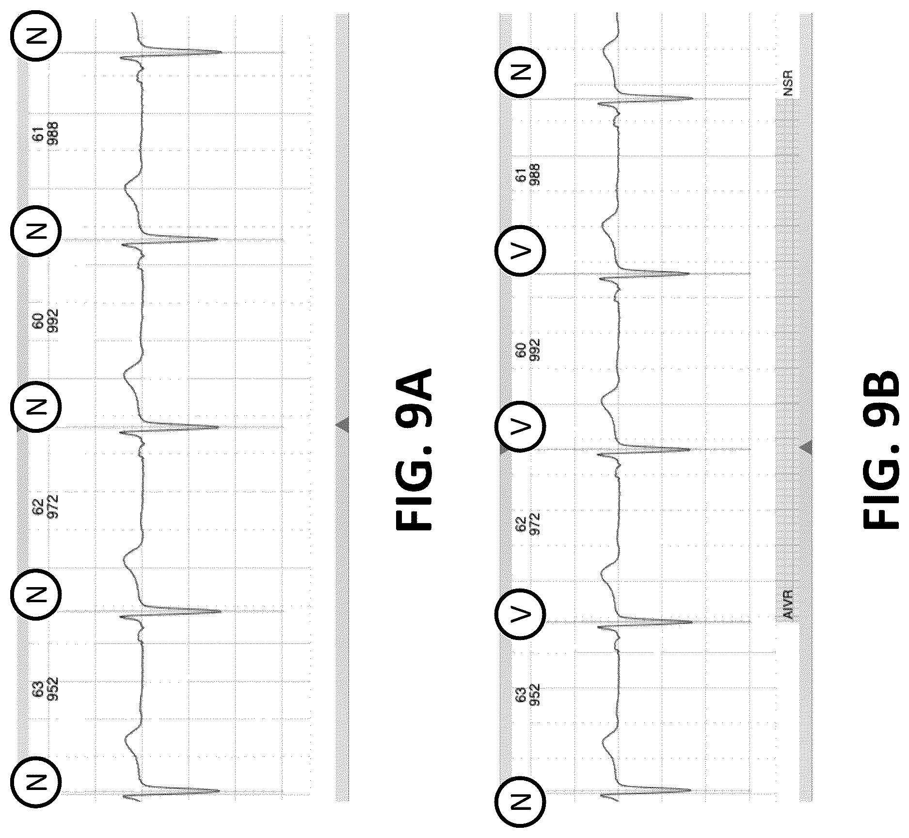 Patent US12616413 Figure 7 – Beat and rhythm reclassification