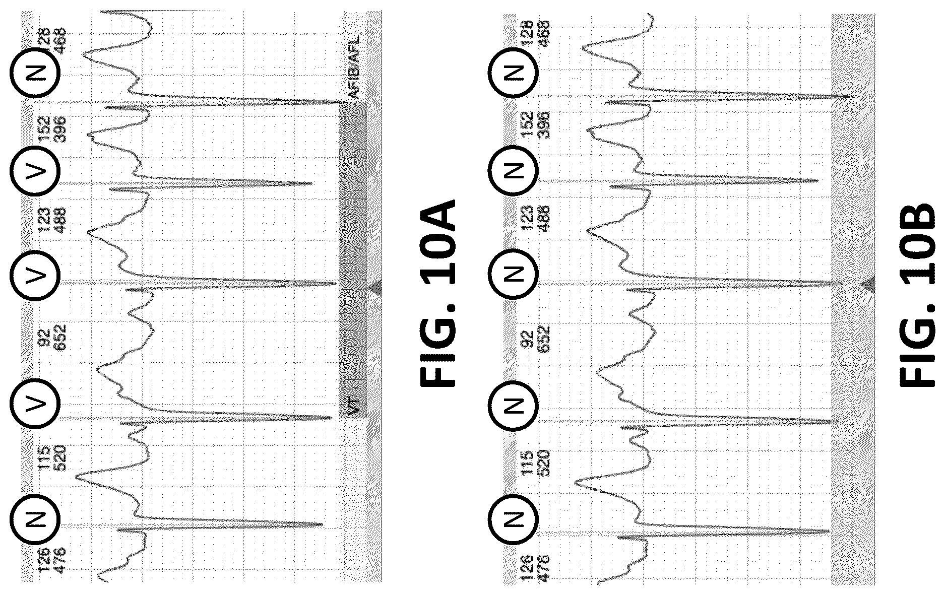 Patent US12616413 Figure 8 – Beat and rhythm reclassification