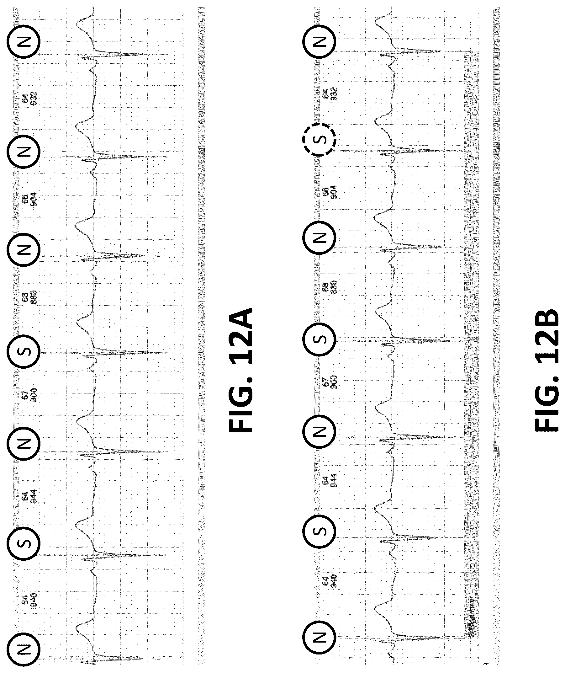 Patent US12616413 Figure 10 – Beat and rhythm reclassification