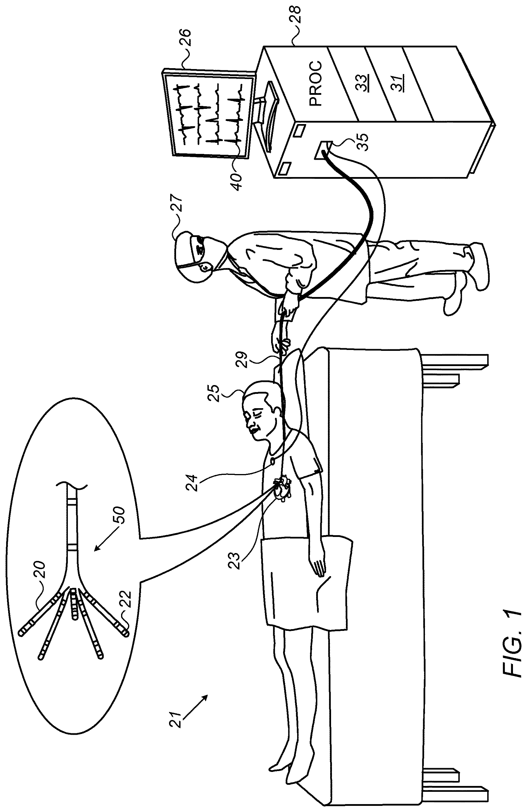 Patent US12616414 — Smart cardiac electrophysiological (EP) map — Figure 1
