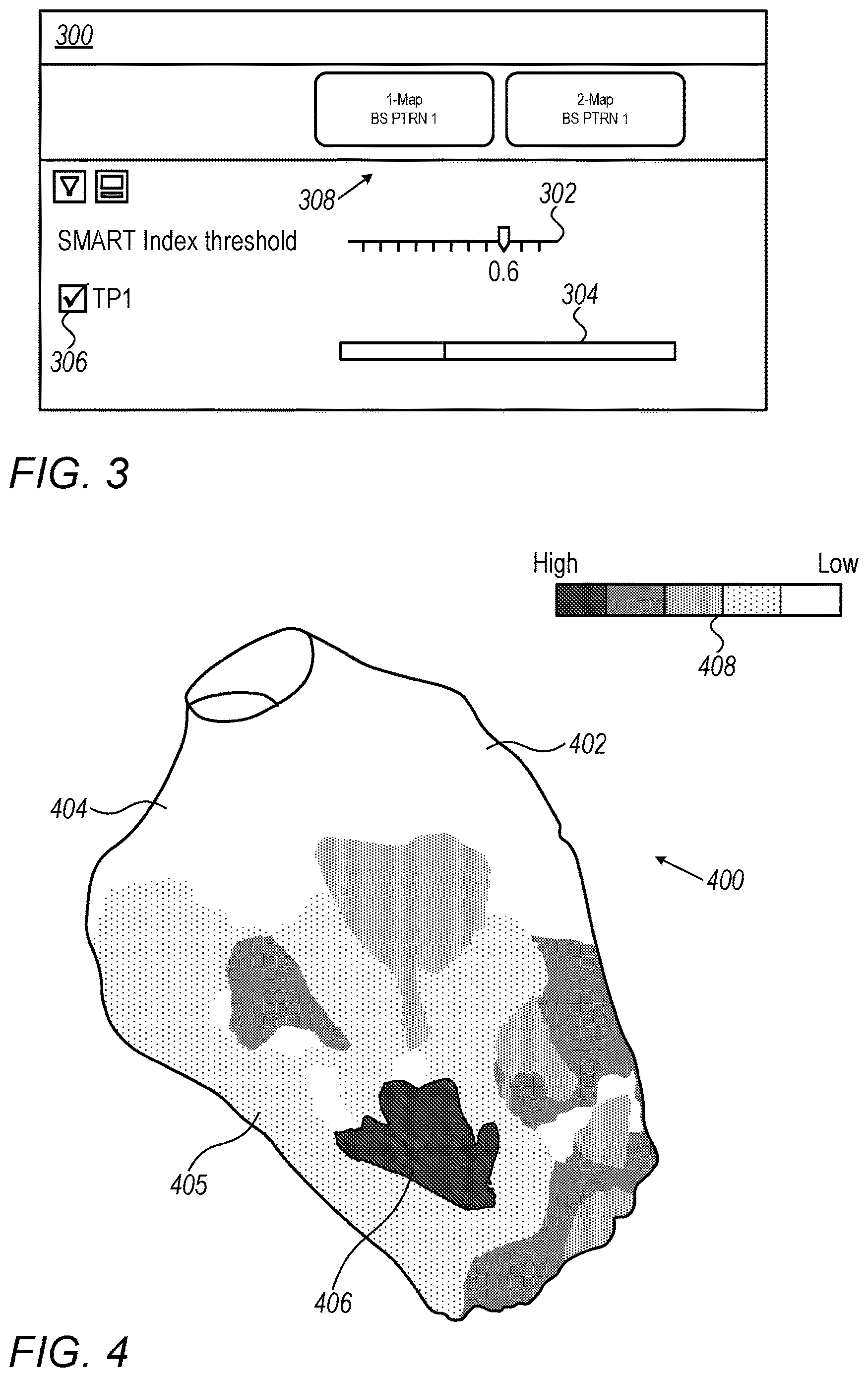 Patent US12616414 Figure 3 – Smart cardiac electrophysiological (EP) map