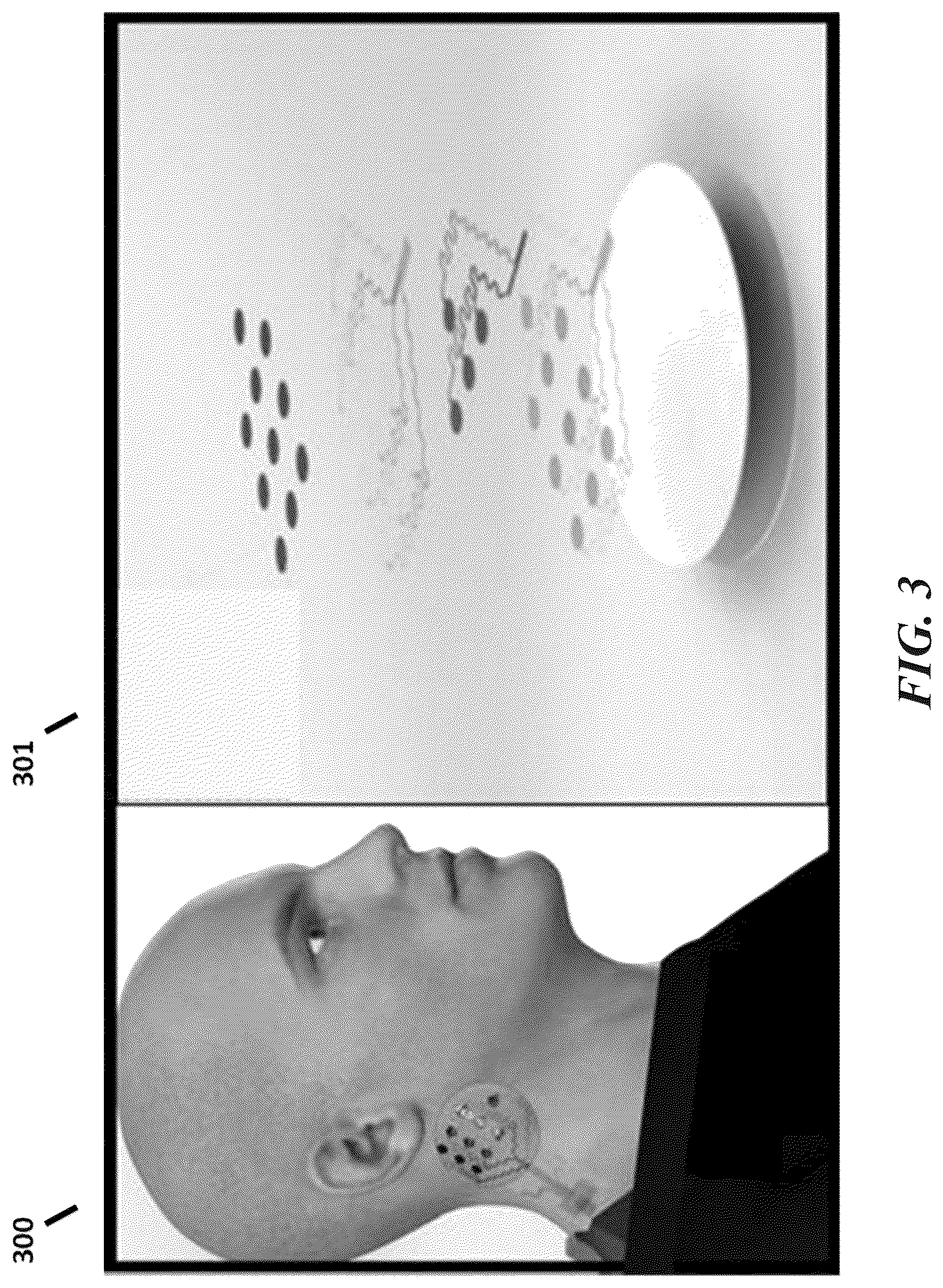 Patent US12616415 Figure 3 – Neural signal detection of immune responses