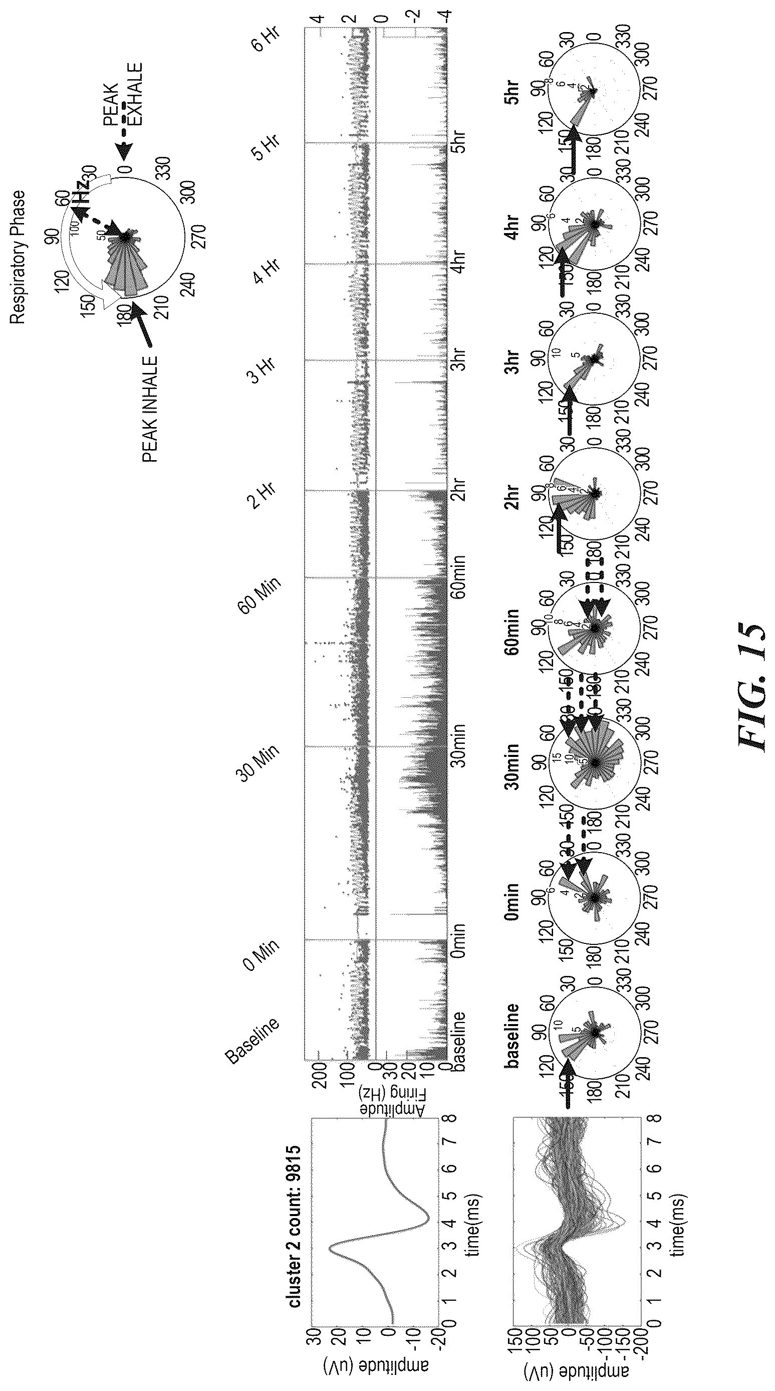 Patent US12616415 Figure 15 – Neural signal detection of immune responses