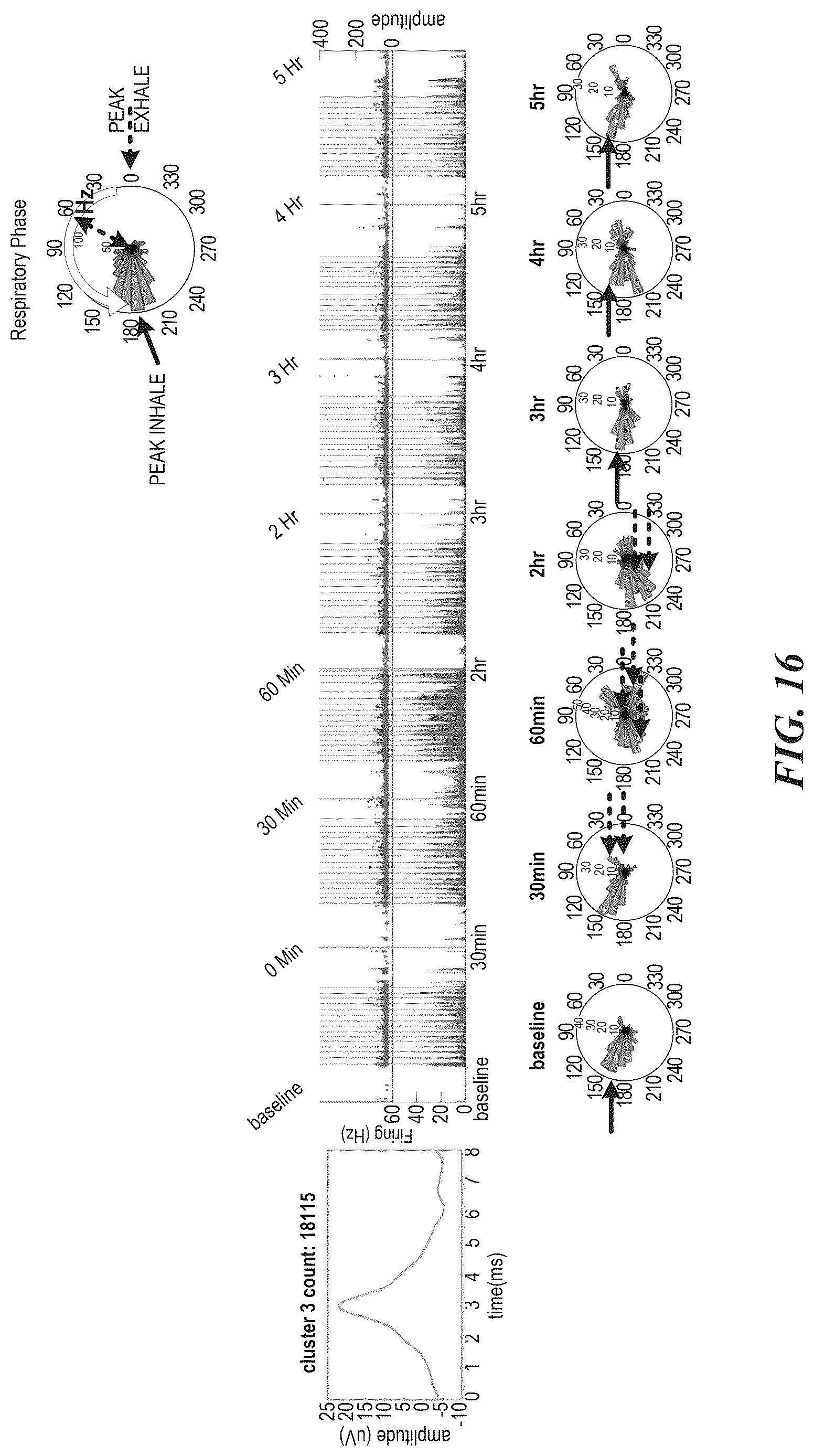 Patent US12616415 Figure 16 – Neural signal detection of immune responses