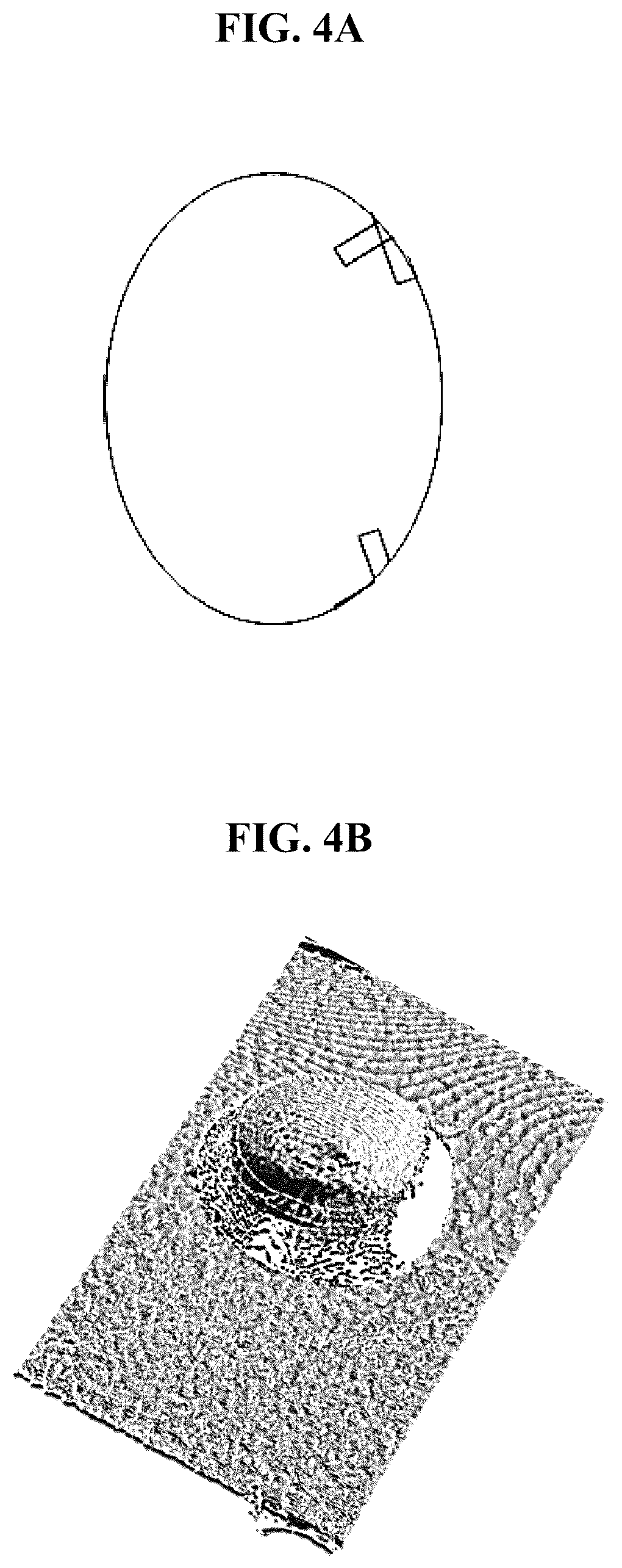 Patent US12616416 Figure 4 – System of monitoring foetal growth, methods of monitoring and forming the system