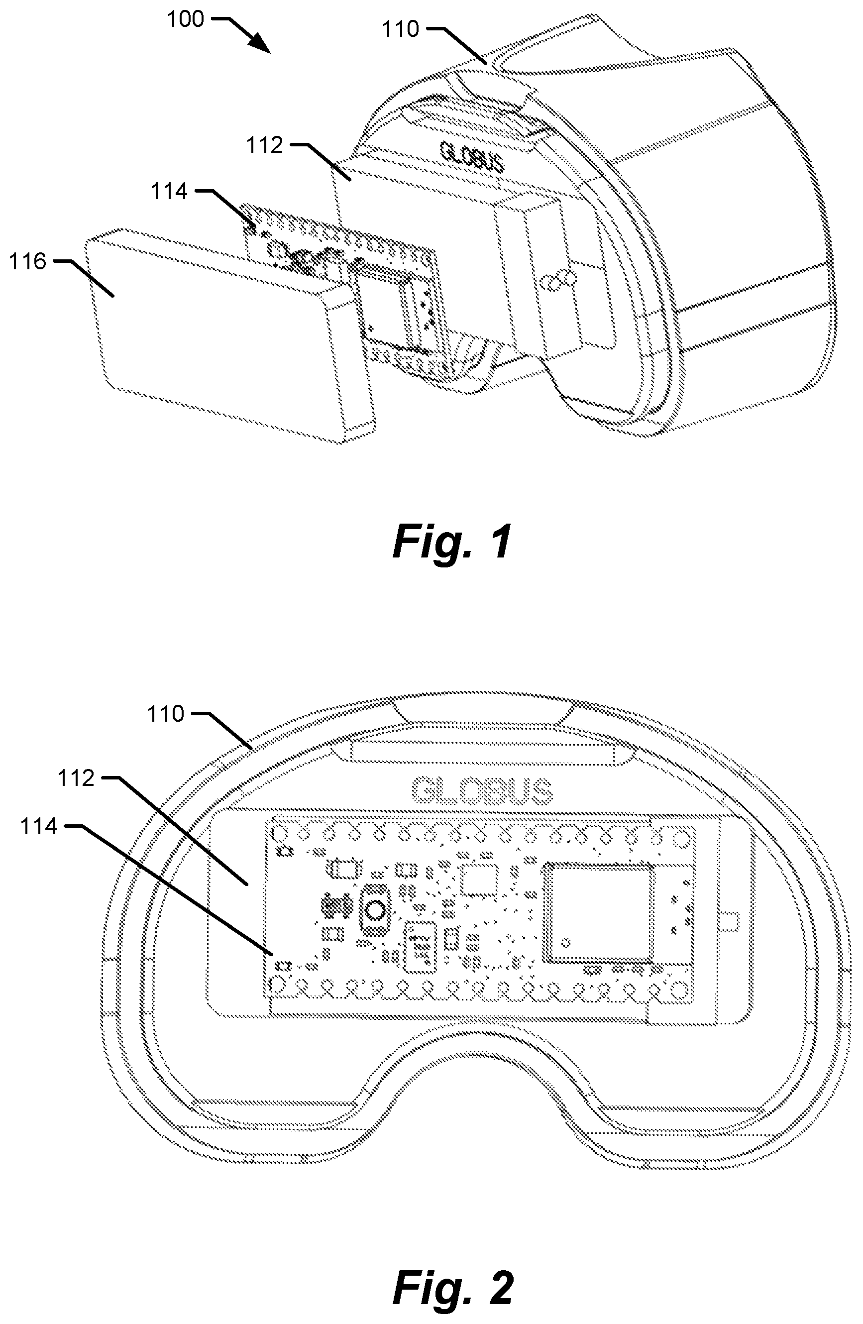Patent US12616418 Figure 1 – Medical implants with circuits treating periprosthetic joint infection and other sensing