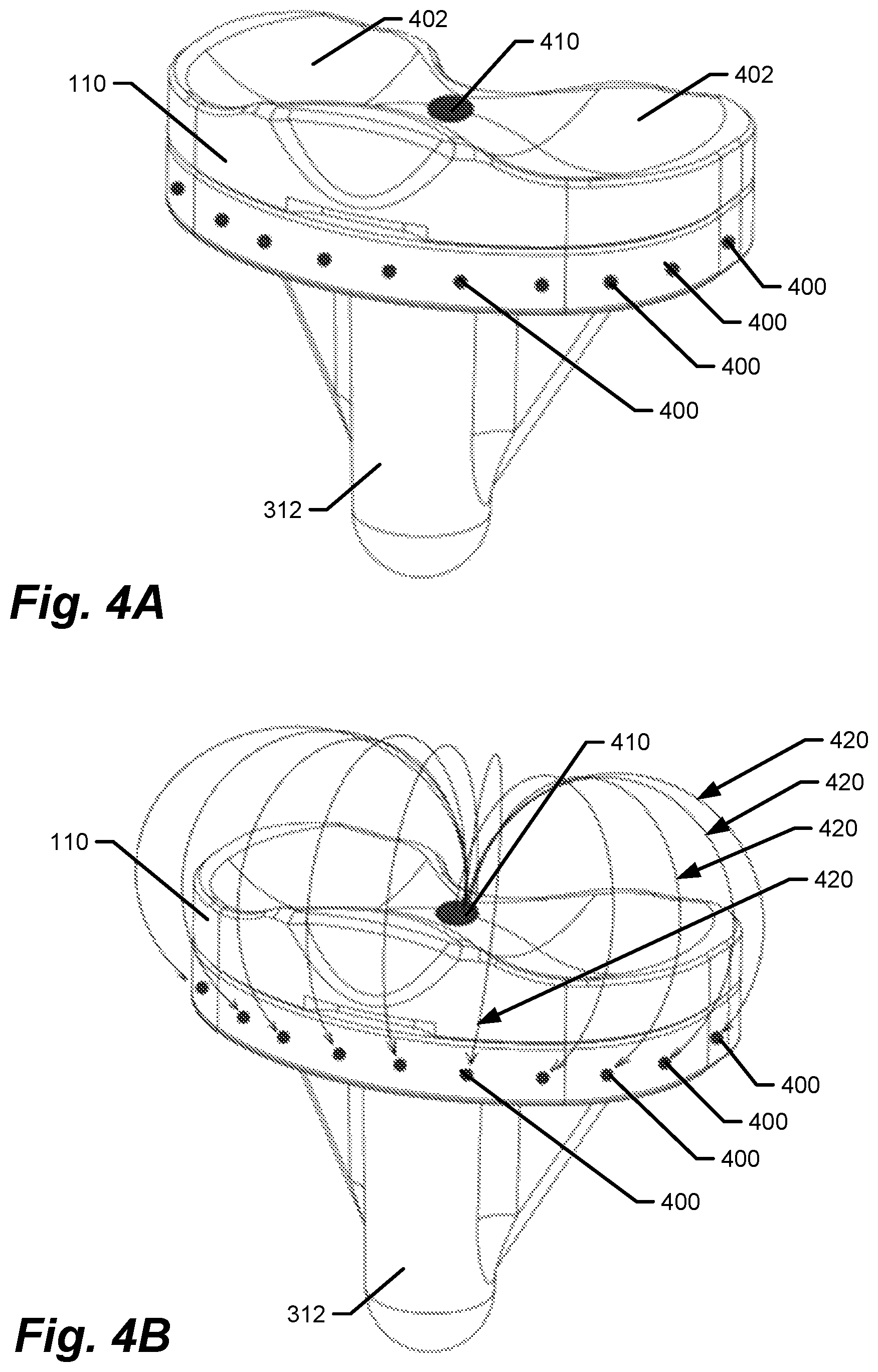 Patent US12616418 Figure 3 – Medical implants with circuits treating periprosthetic joint infection and other sensing