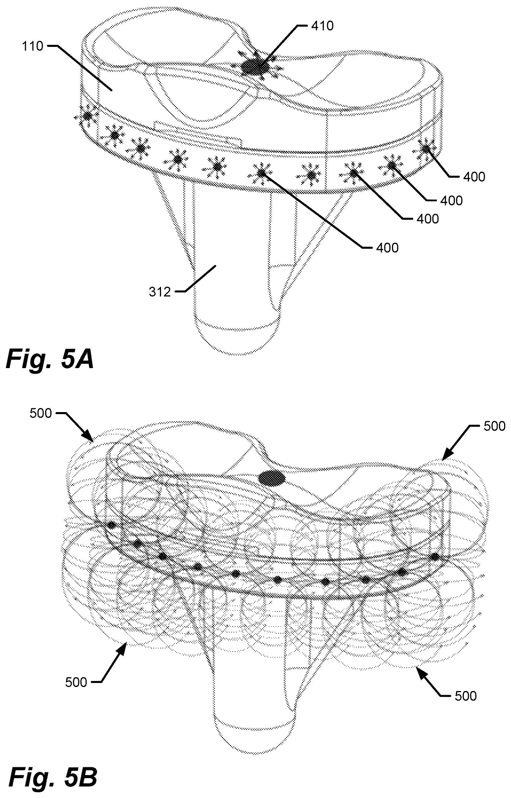 Patent US12616418 Figure 4 – Medical implants with circuits treating periprosthetic joint infection and other sensing