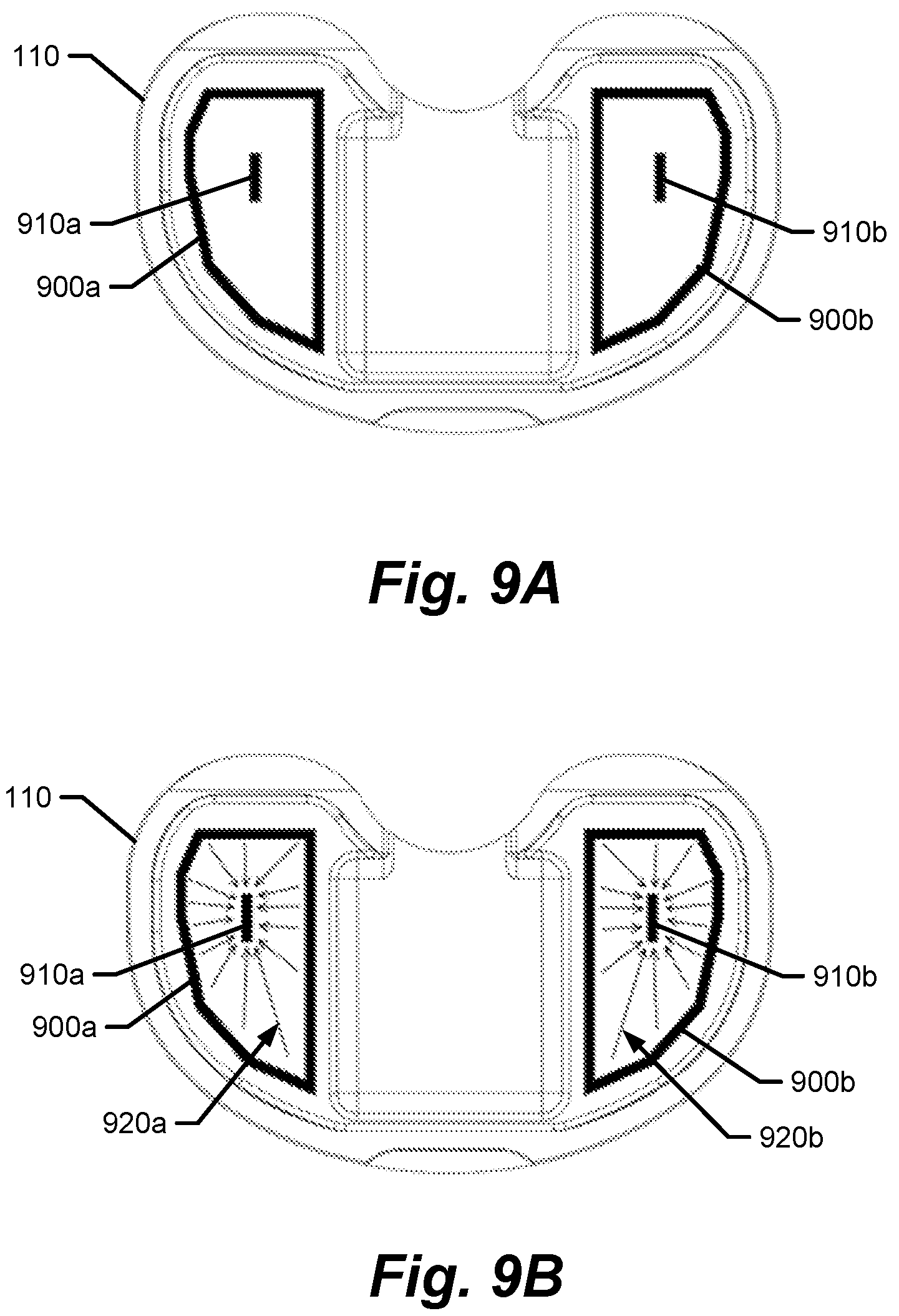 Patent US12616418 Figure 7 – Medical implants with circuits treating periprosthetic joint infection and other sensing