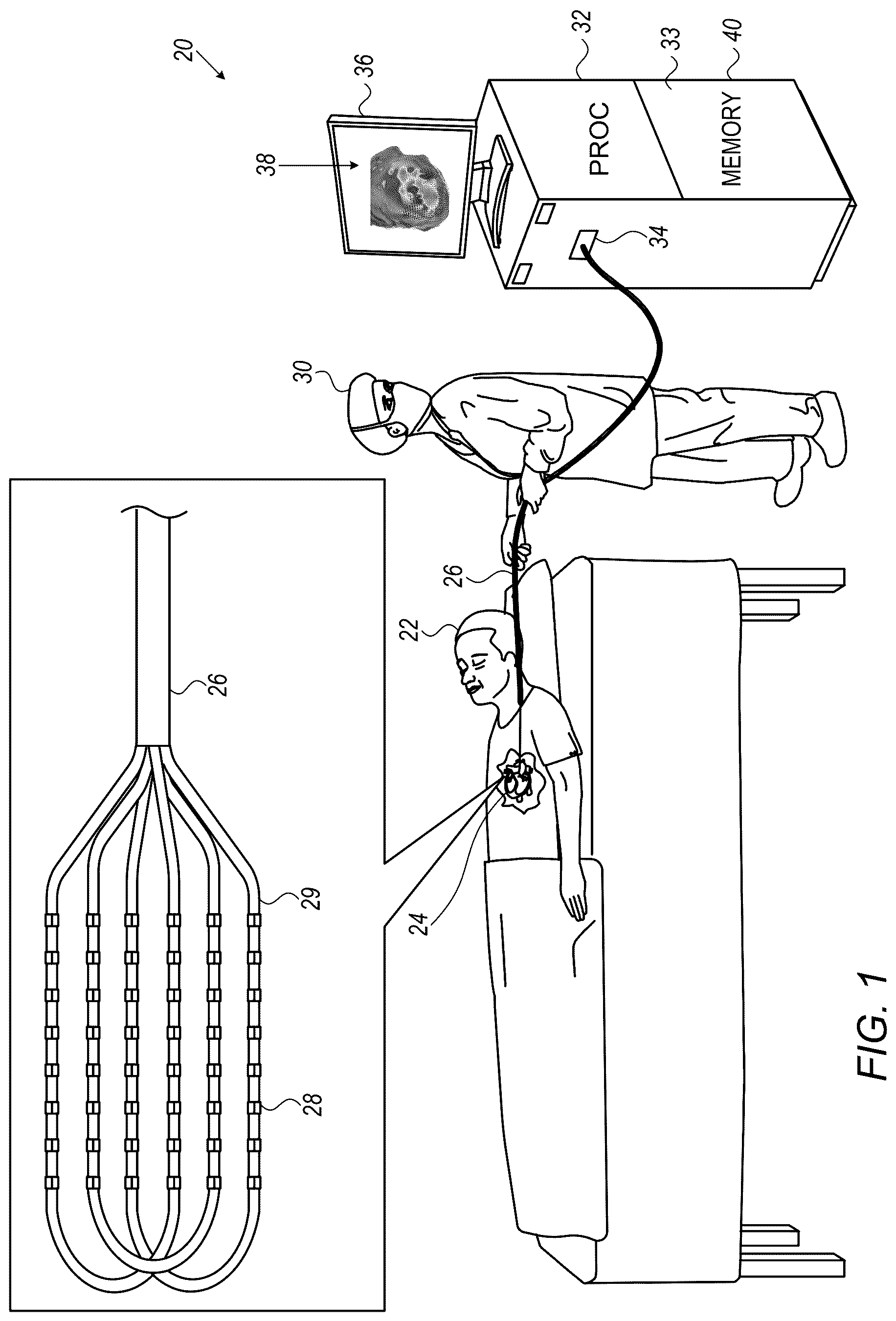 Patent US12616420 Figure 1 – Computing local propagation velocities for cardiac maps