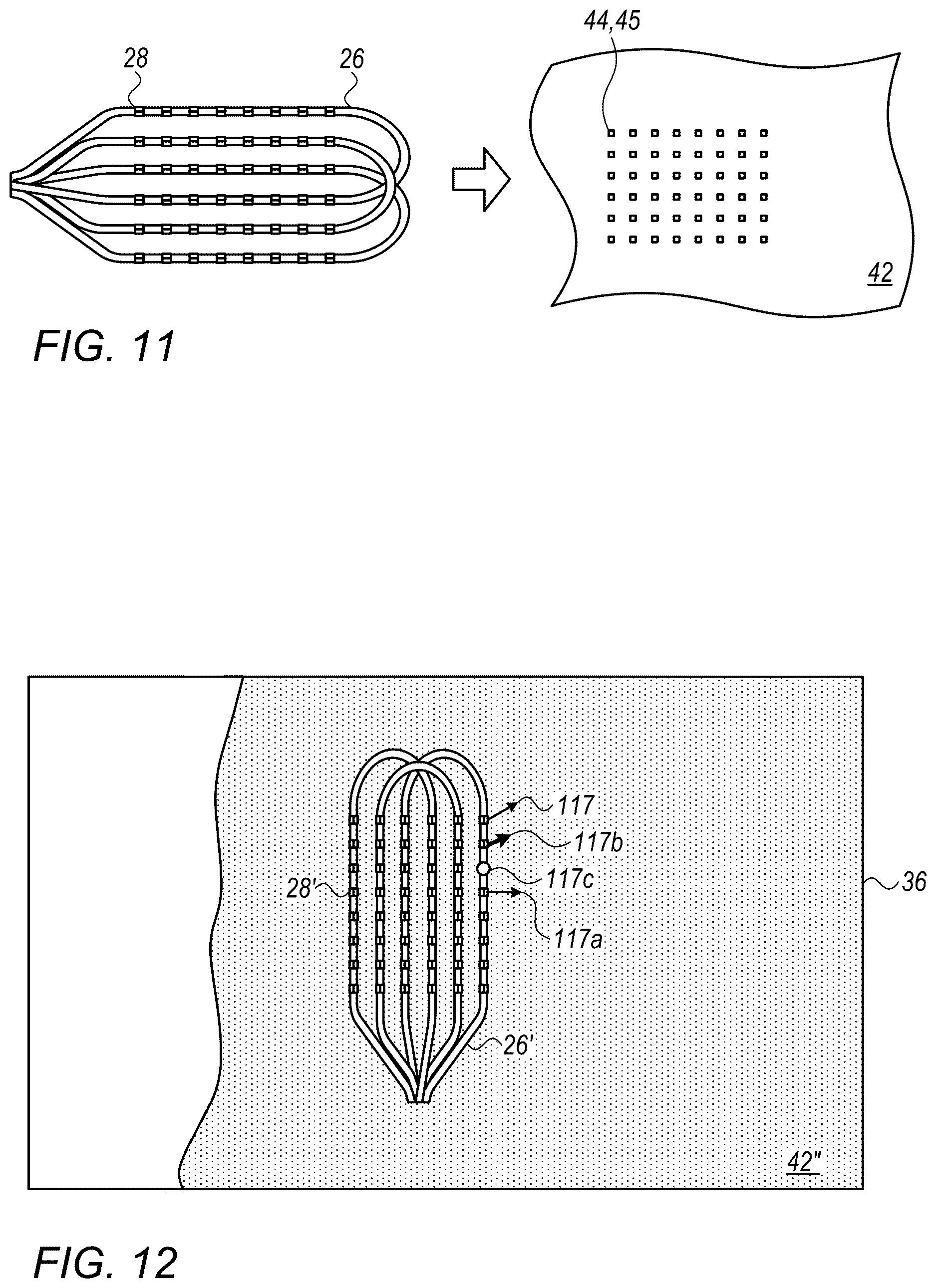 Patent US12616420 Figure 11 – Computing local propagation velocities for cardiac maps
