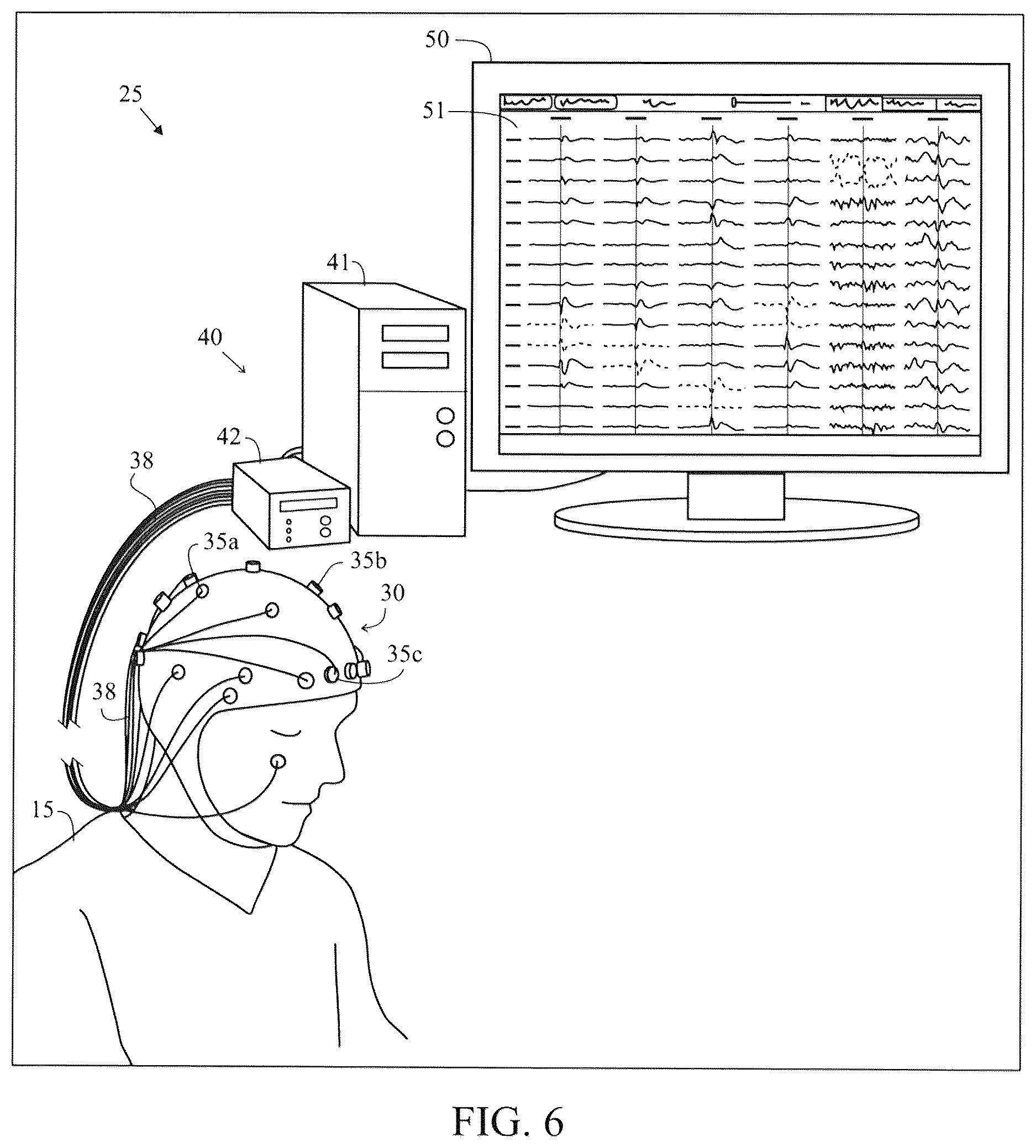 Patent US12616421 Figure 7 – System and method for generating a probability value for an epileptiform abnormality by neural network to identify signal spikes