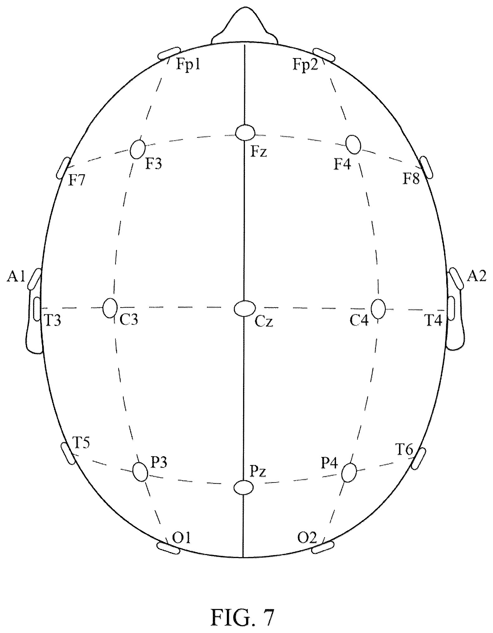 Patent US12616421 Figure 8 – System and method for generating a probability value for an epileptiform abnormality by neural network to identify signal spikes