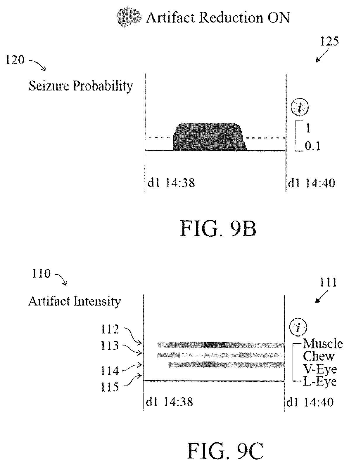 Patent US12616421 Figure 12 – System and method for generating a probability value for an epileptiform abnormality by neural network to identify signal spikes