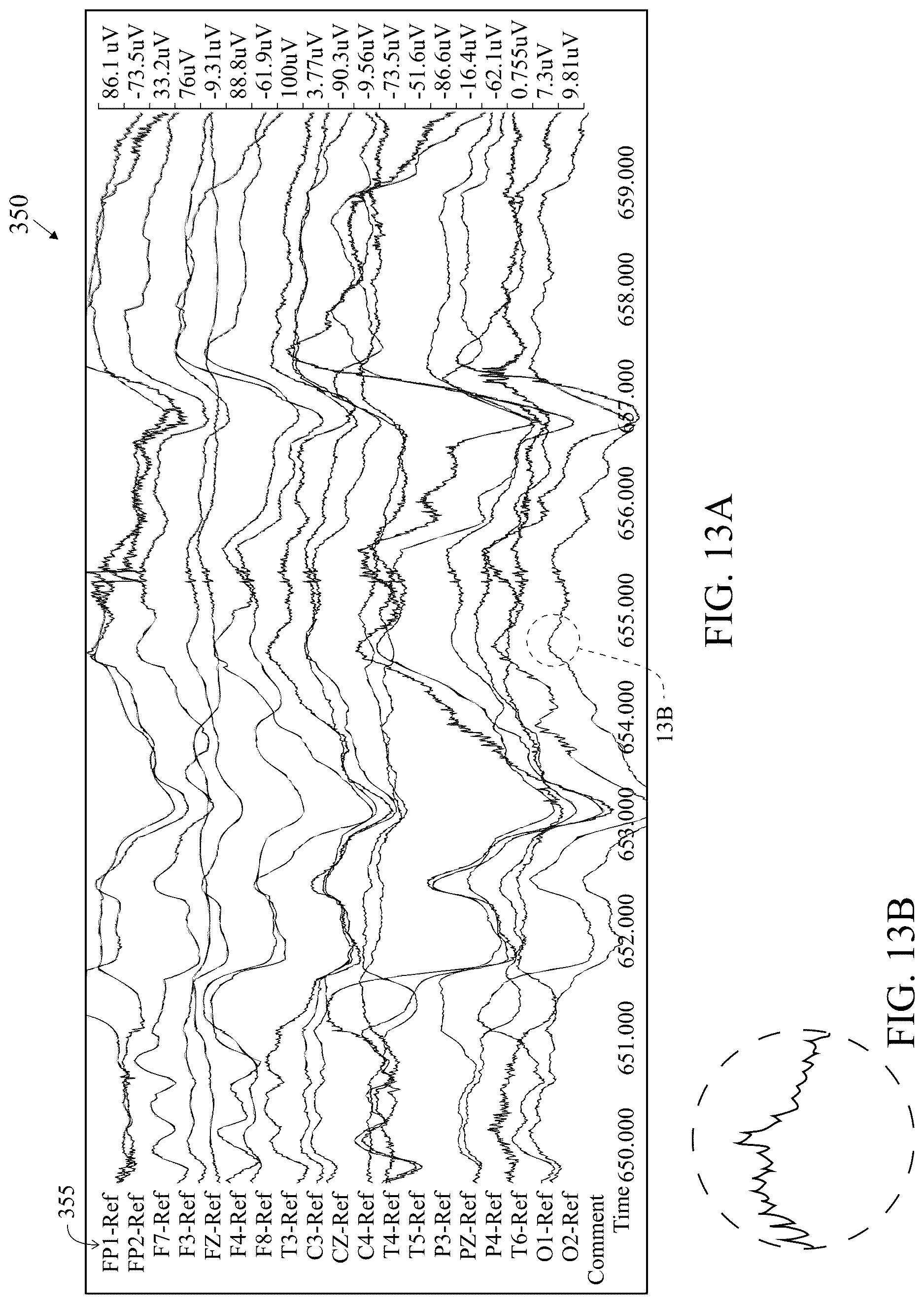 Patent US12616421 Figure 16 – System and method for generating a probability value for an epileptiform abnormality by neural network to identify signal spikes