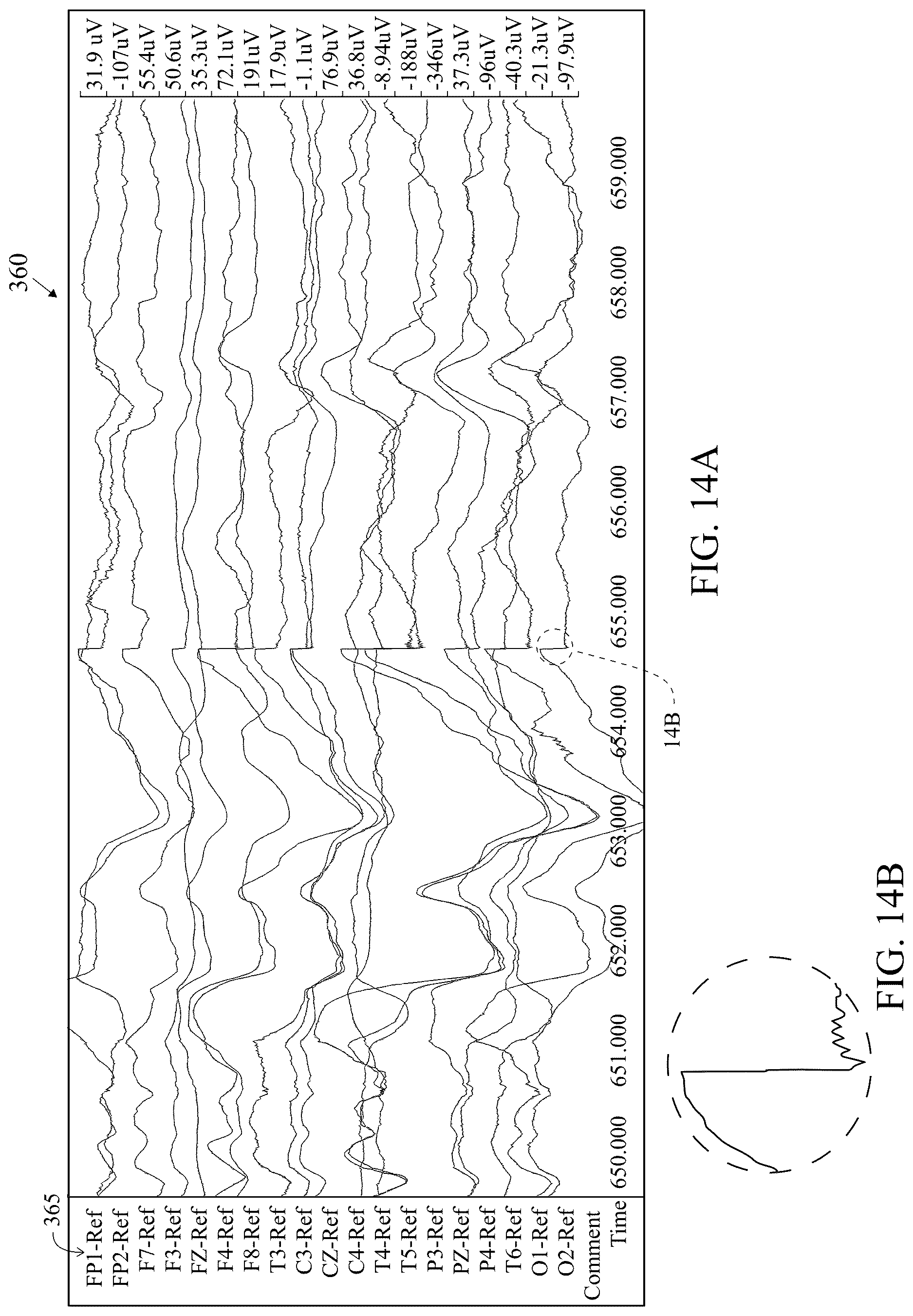 Patent US12616421 Figure 17 – System and method for generating a probability value for an epileptiform abnormality by neural network to identify signal spikes