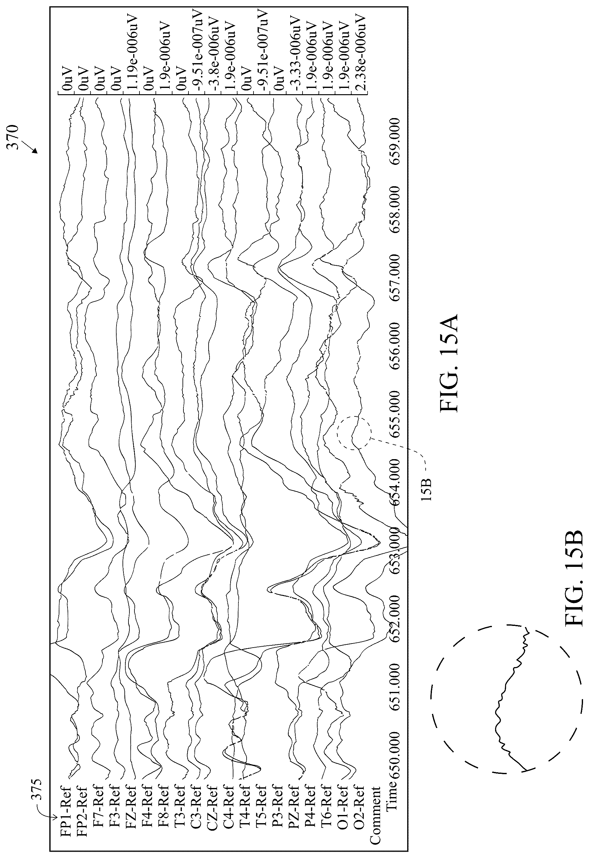 Patent US12616421 Figure 18 – System and method for generating a probability value for an epileptiform abnormality by neural network to identify signal spikes