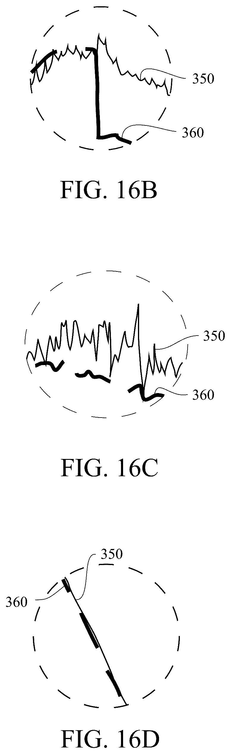 Patent US12616421 Figure 20 – System and method for generating a probability value for an epileptiform abnormality by neural network to identify signal spikes