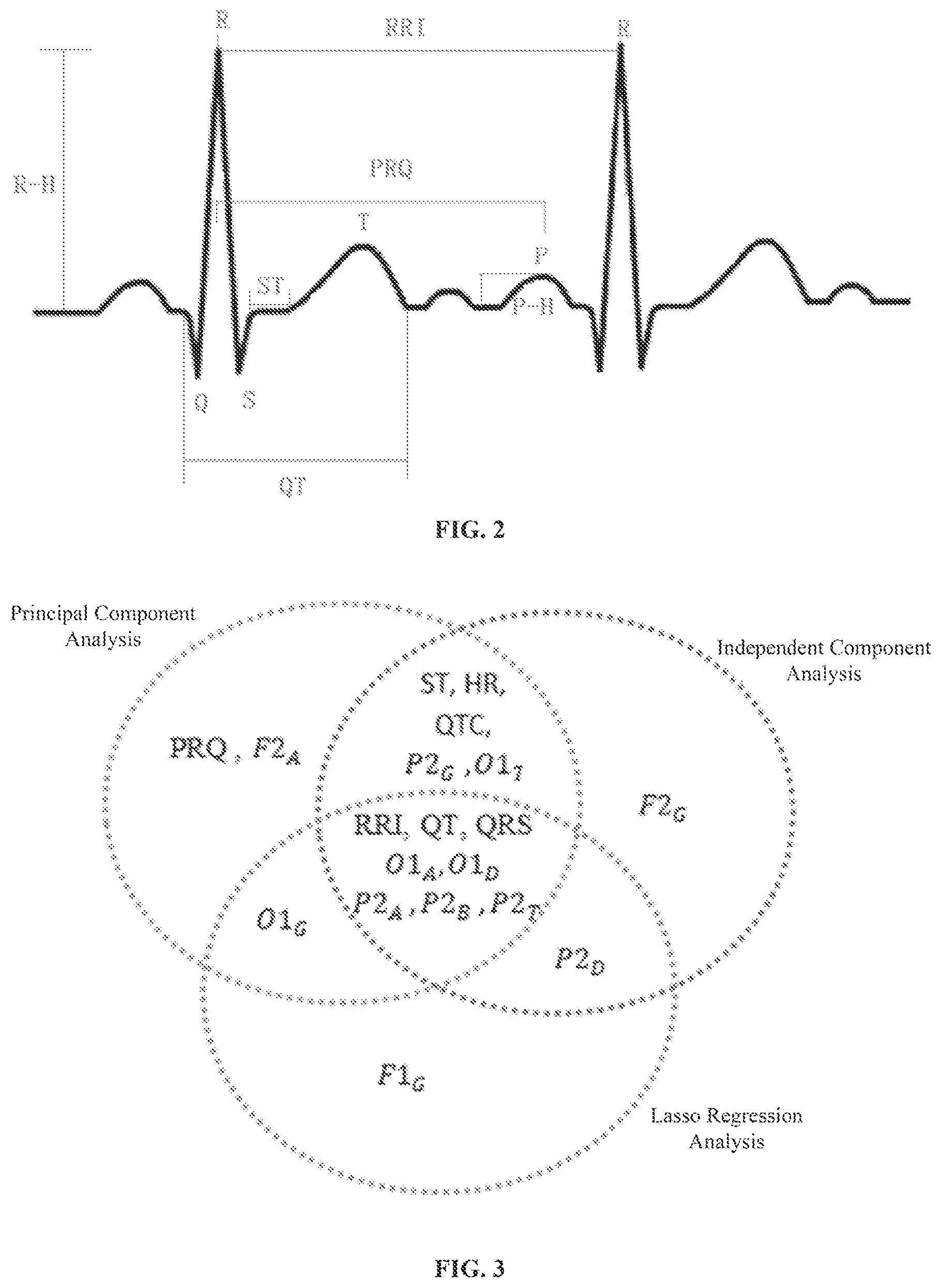 Patent US12616422 Figure 2 – Prediabetes detection system and method based on combination of electrocardiogram and electroencephalogram information