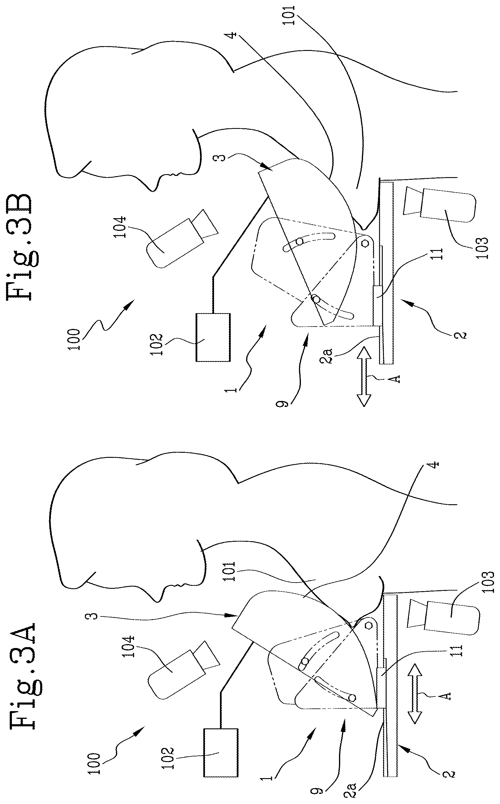 Patent US12616432 Figure 3 – Compression device for breast exams and diagnostic apparatus for breast exams
