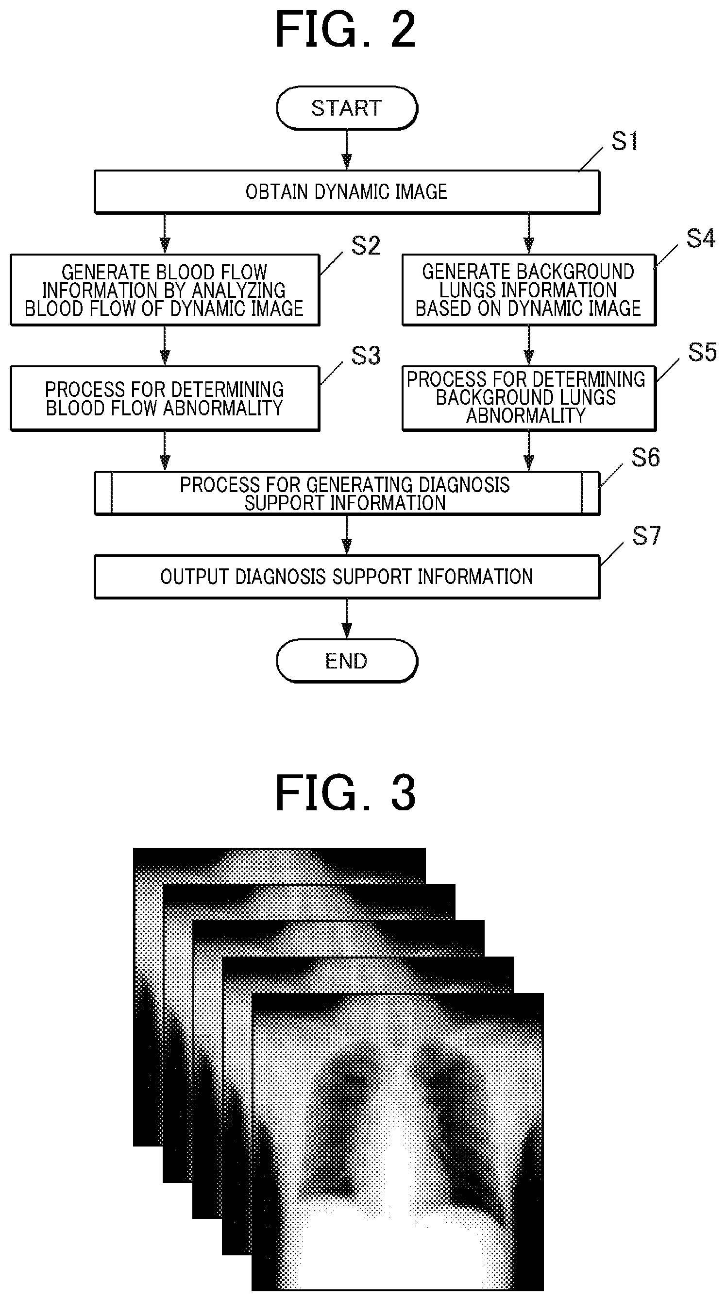 Patent US12616436 Figure 2 – Pulmonary embolism diagnosis support apparatus, pulmonary embolism diagnosis support method, and storage medium