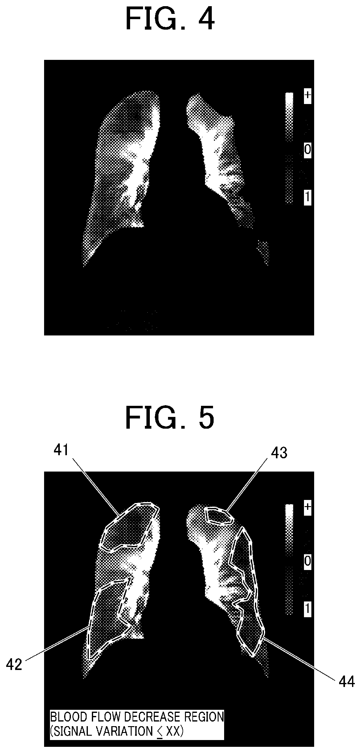 Patent US12616436 Figure 3 – Pulmonary embolism diagnosis support apparatus, pulmonary embolism diagnosis support method, and storage medium