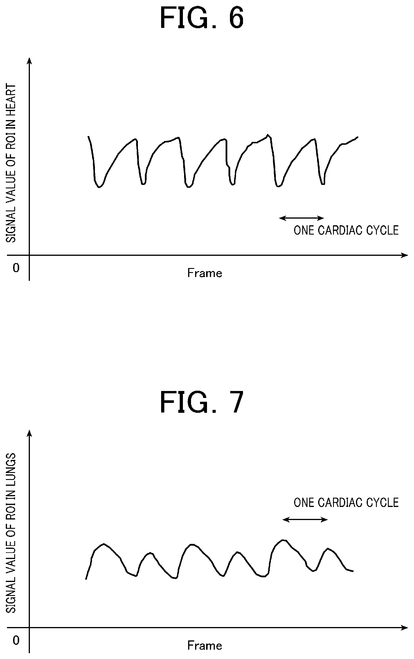 Patent US12616436 Figure 4 – Pulmonary embolism diagnosis support apparatus, pulmonary embolism diagnosis support method, and storage medium