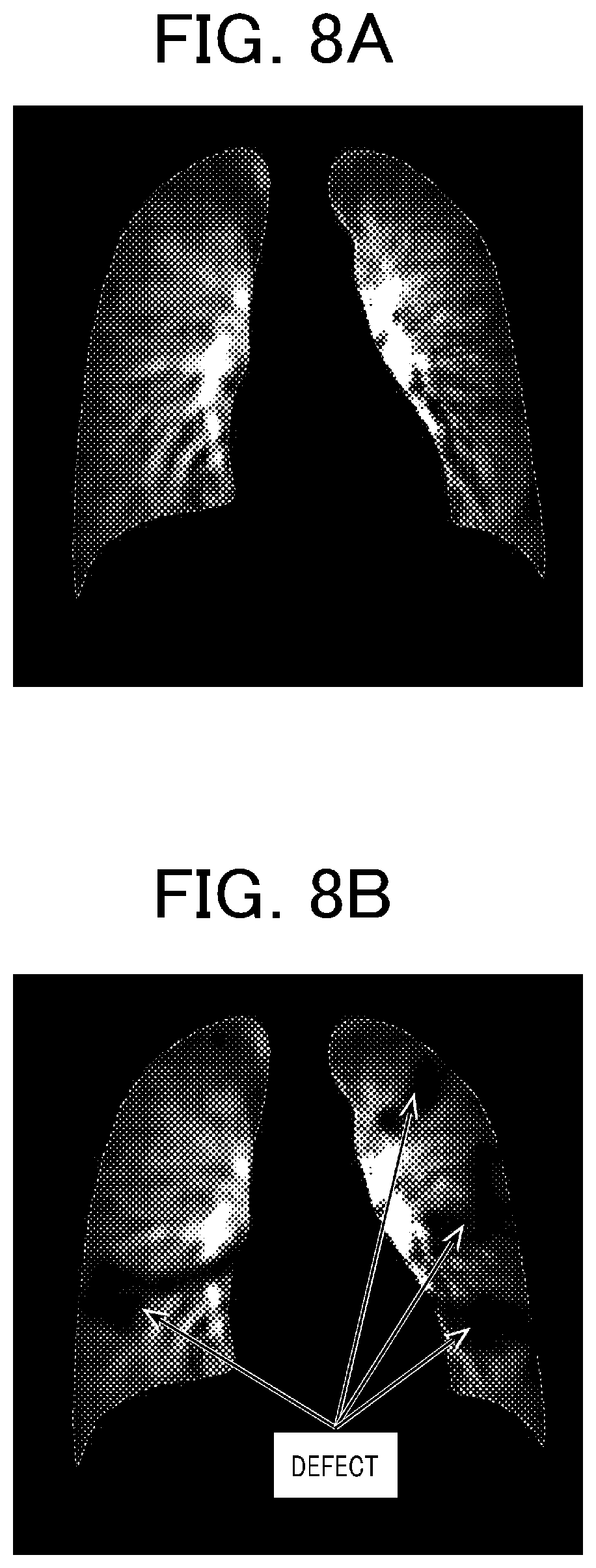 Patent US12616436 Figure 5 – Pulmonary embolism diagnosis support apparatus, pulmonary embolism diagnosis support method, and storage medium