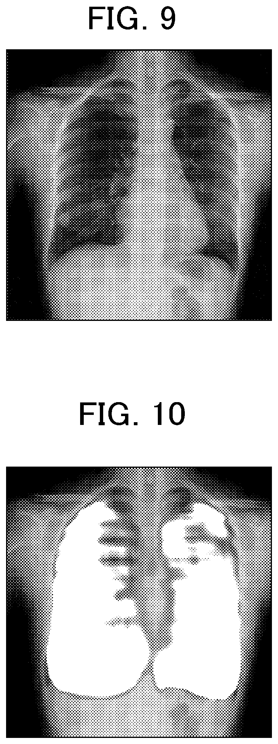 Patent US12616436 Figure 6 – Pulmonary embolism diagnosis support apparatus, pulmonary embolism diagnosis support method, and storage medium