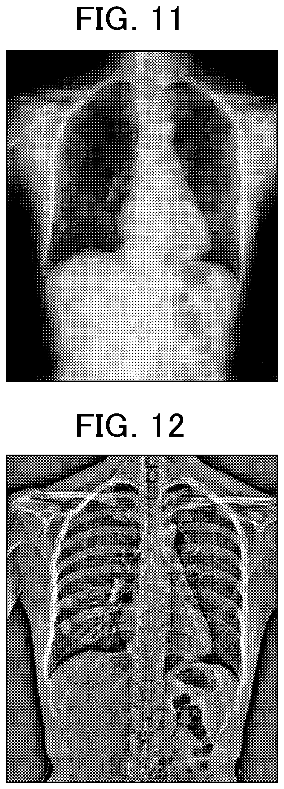 Patent US12616436 Figure 7 – Pulmonary embolism diagnosis support apparatus, pulmonary embolism diagnosis support method, and storage medium