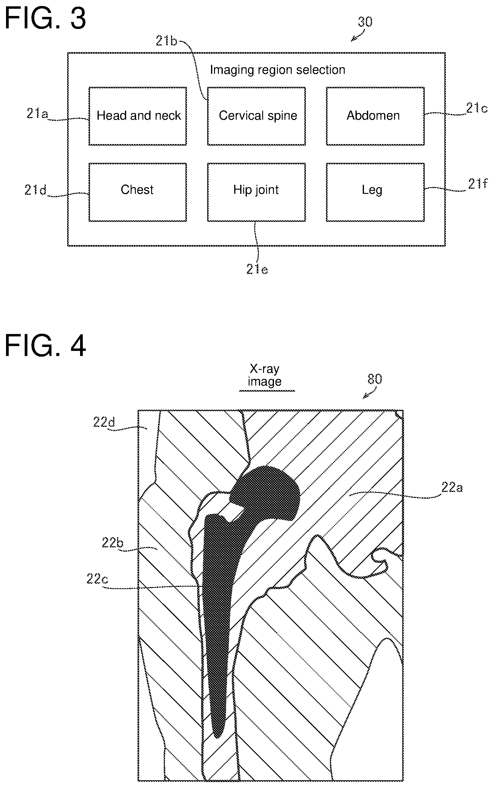 Patent US12616437 Figure 3 – X-ray imaging apparatus