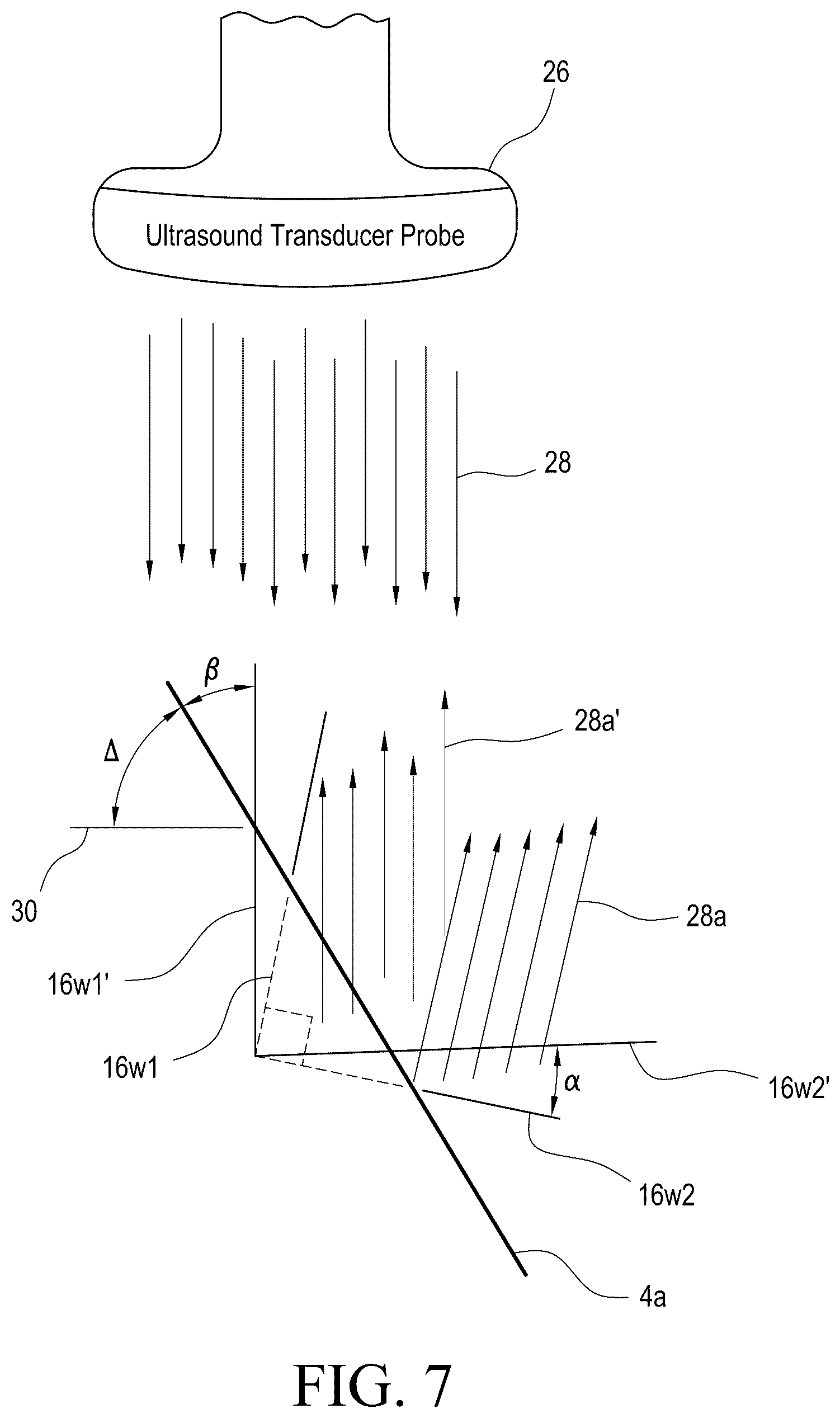 Patent US12616438 Figure 4 – Echogenic needle